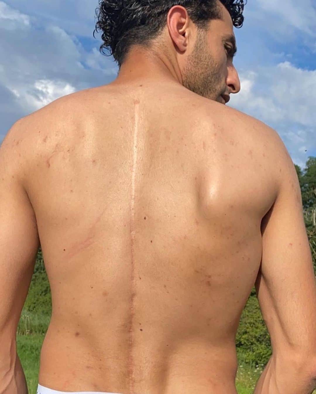TOUZANI TVのインスタグラム：「This is why I started to practise Freestyle Football & the reason I became a pioneer of Freestyle Football. You know my name... Now you’ll know my story .. I have a crooked back. I had to have surgery at a young age. A 30 centimeter iron pin had to be placed in my back. But I am more grateful than ever. This was the start of my journey and in particular my very first video. With this story I want to motivate you to always get the best out of yourself ❤️💪🏼🦵🏼」