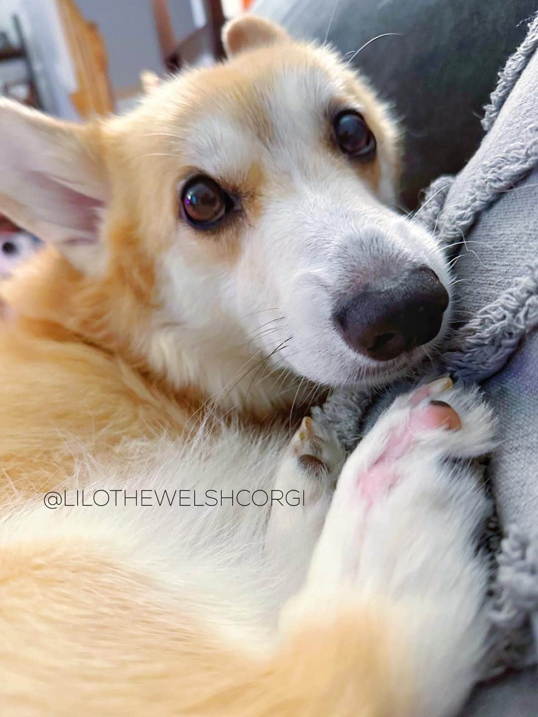 Liloのインスタグラム：「There’s beauty in imperfections. This is how my foot looks after cancer surgery. It’s not perfect but I’m still me. We’re all perfectly imperfect! ❤️ #Corgi」