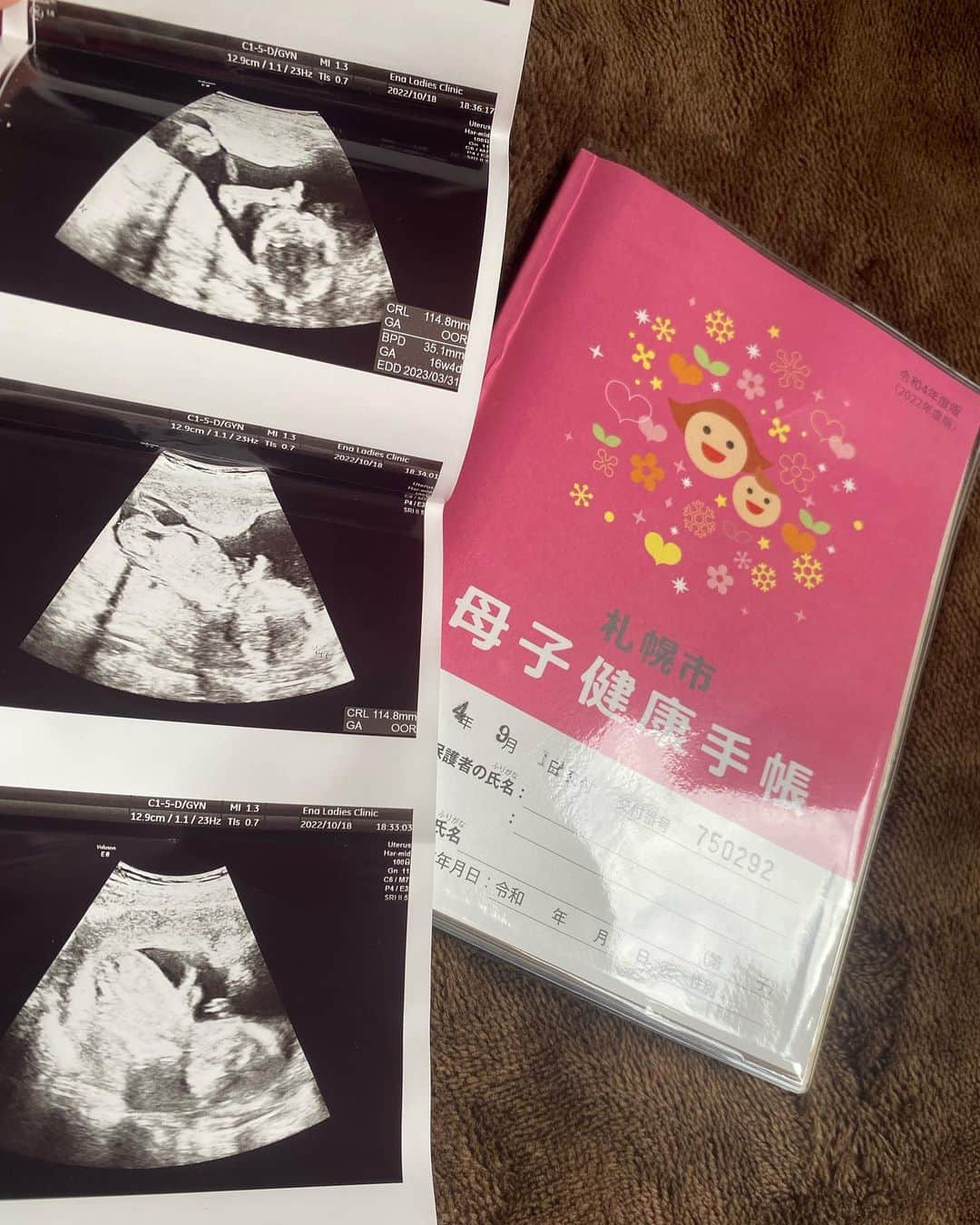 CHOCOのインスタグラム：「暴れん坊な男の子👼🏻🍼💕 最後のエコーの写真お尻と足可愛すぎる🫣💕」
