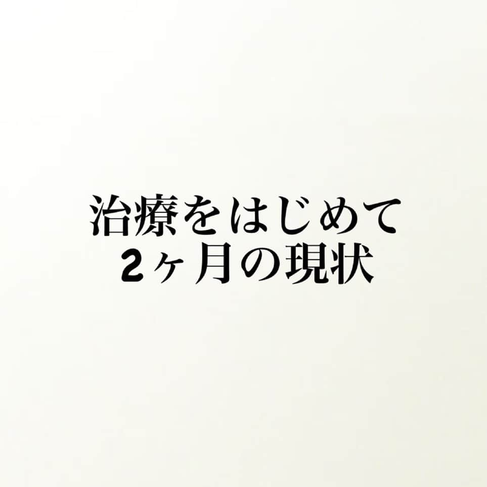 藤井瑞希さんのインスタグラム写真 - (藤井瑞希Instagram)「・ ・ 【現状】 ・ 治療をはじめて、2ヶ月とちょっとが経ちました。 ・ まだ2ヶ月くらいか〜 とっても長い時間を過ごした気がする。 ・ 昨日は、定期検診でした。 いつもまずは採血をして、その後診察という流れ。 毎回、この瞬間はドキドキソワソワ。 ・ 悪くなってたらどうしよってね。 しかし、昨日の結果は、なんと少しですが数値が上がってました🥹✌️ ・ 今の治療は、飲み薬のみで進めているので、元々先生からも結果は長い目で見といてくださいって言われていましたし、ここまでもほとんど数値は、横ばいだったから、とにかく嬉しかったです。 ・ 免疫力も正常値にはまだ届きませんが、少しだけ上がったそうで、気をつけた方がいい行動が緩和されました🥲💓 ・ とは言っても、この冬のコロナ感染やインフルエンザなどには、まだまだ人一倍敏感に過ごした方がいいくらいの免疫力なので、この冬を今までと変わらず、油断せず、過ごしていきたいと思います。 ・ そうだそうだ！ 薬の数も２種類減りました。 薬が多すぎて、たまに体調崩していたので嬉しいです。 ・ 春頃にはもっと、行動緩和されるように今は耐えるぞ。 ・ という、私にとってとても嬉しい１日になりました。 ・ いつも応援ありがとうございます。 引き続き、頑張ります。 ・ ・ #再生不良性貧血 #治療中 #藤井瑞希 #闘病生活」11月23日 13時24分 - bdmntnfujiimizuki