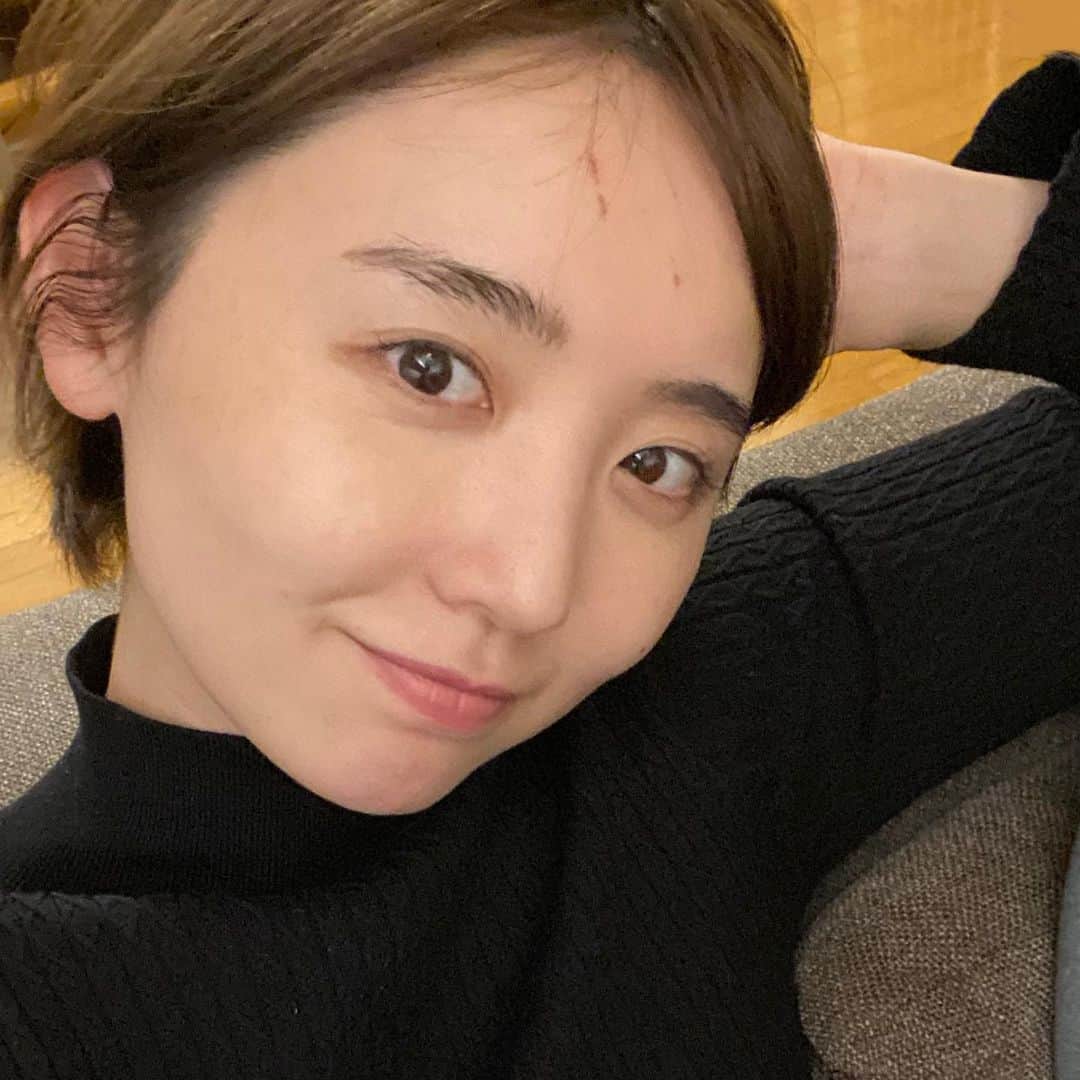 おのののかのインスタグラム：「✨ はじめてのハイフ @the_roppongi_clinic  かなり調子良くて久しぶりに ソロで自撮りしちゃってみたり🥰笑  ちなみに おでこ、ほっぺ、鼻横の傷は、 うちのポチタにやられました🐶笑 @chainsawman_pr   １歳になった娘、最近すごく力が強くて ひっかかれたり、叩かれたりすると 結構痛いし傷ができる🥹 (爪はちゃんと切ってます❣️)  そのとき、どれくらいのテンションで 注意するのが正しいのだろうか🤔  痛くてリアクションすると 逆に面白がったりするし、、🫠  どうしましょ、、？🫠🫠🌱」