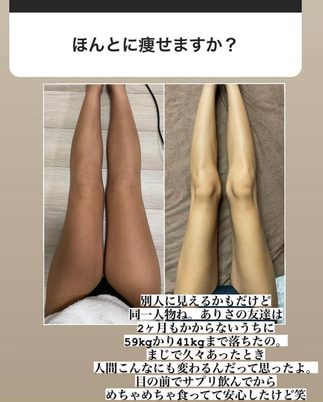 井上ありささんのインスタグラム写真 - (井上ありさInstagram)「【速報】これ本当に早い者勝ち。 ・ ・ ありさが少しから" 本当に痩せすぎる "と ストーリー投稿したDIETに付いて ・ ・ かれこれ2週間位？載せてきたけど 会社様からゲリラ値下げキャンペーン開始😭 980円がまさかの798円に😭 有難く？も？かなり売れているのが理由みたい😭❤️‍🔥 やばいよね、個人的に使ってただけなのに笑 ・ ・ ありさがこれに出会ったの半年程前です。 エステしてる友人や、細い子が使っていて 皆、口を揃えて"痩せすぎる。"というから ・ ・ 半信半疑の中使ったら 本当に2.3日後体重が約3kg位減って そこから妊娠が分かって増えつつあったのに また最近がくん！と落ちたの😂 ・ ・ 半年も使い続けたら体脂肪も下がって 見た目もどんどん引き締まってきた。 (運動・食事制限もちろんなし) ・ ・ そしてその神サプリ会社様から  " ありさ限定URL " を発行していただき… いつ終わるか分からないみたいなので 正直もう冬は太りたくないとか 絶対に痩せたいって子は今すぐ買いな‼️ ・ ・ 本当に本当にまだ悩んでて買ってない子 無くなっても絶対に後悔しない？😢 と、言いたい。本当に私の妊娠中、産後の 支えになるであろう人生を変えた物だから。笑 ・ ・ まだまだ説明できてない部分、知りたい部分 沢山あると思うので現在のストーリーを見て下さい😭‼️最後の最後までしっかり載せます！ ・ ・ 本当に買ってよかったと思って貰える自信ある。 一番いいたいのは、数々のサプリを試してきた中でも 私の妊娠中なのにもかかわらず 痩せた体型が証明です。笑  後はフォロワー様の声。 嘘無しで痩せます。という事です。 ・ ・ ⚠️ただし、痩せすぎる方も過去に何人もいたので 痩せたいと心から思ってない方は絶対に 買わないでください💦🙇本当に使わないで欲しい。 ・ ・ ◤  @saburina1016 ◢ ・ ↑タップしてストーリー＆ハイライトを 見て下さい！体型の悩みを本当に解決できます！ ありさと一緒に頑張ろ🥺ずっと皆様と一緒に頑張り続けるから笑 産後も楽しみだし笑」11月30日 22時21分 - saburina1016