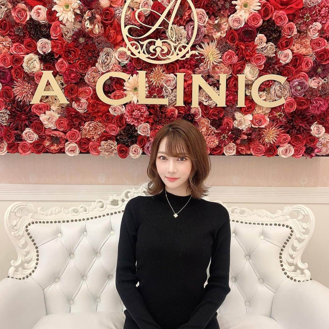 高辻千夏のインスタグラム：「@a_clinic_osaka ⁡ 先日、ACLINIC大阪院で受けた  #1day小顔脂肪吸引 から約2週間が経過…🌱𓂃 𓈒𓏸 ⁡ ⁡ フェイスラインが綺麗なVラインになって感激！ ⁡ 写真2枚目のbefore after📸 施術直後から効果を感じるほど…💭‪‪❤︎‬ ⁡ ⁡ 施術中は、ほとんど感覚がなくて痛みも気にならないし ⁡ ダウンタイムですが…腫れることもなくって施術直後から予定を入れても大丈夫でした🙆🏻‍♀️💖 ⁡ ⁡ 担当してくださった、 田窪賢志郎 院長先生 (@aclinic_takubo) 👨🏻‍⚕️✨ ⁡ とっても優しくて親切な先生なので、 気になる方は相談してみて下さい👀🤍 ⁡ ⁡ ⁡ #aclinic #aクリニック #エークリニック #aclinic銀座 #aclinic横浜 #aclinic新宿 #aclinic名古屋 #aclinic大阪 #美容外科 #美容皮膚科 #1day小顔脂肪吸引 #1day小顔 #脂肪吸引 #小顔 #美肌 #二重あご #フェイスライン #糸リフト #aスレッド #顔痩せ #部分やせ #小顔整形  #小顔になりたい #横顔美人 #田窪賢志郎」