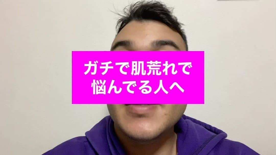 クリス（ありんくりん）のインスタグラム：「ほんとだから信じて！ #クリスでーす」
