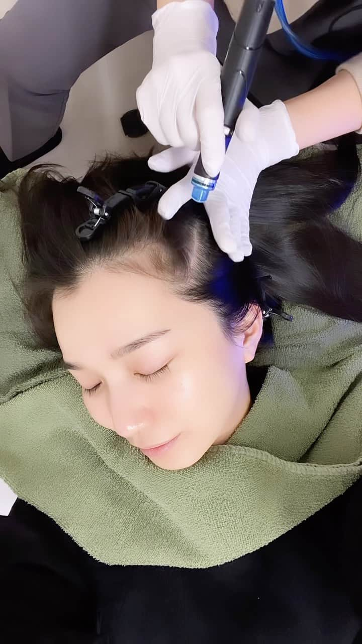 芹那のインスタグラム：「@u_beautyclinic22 💆🏻‍♀️へ💓  ずっと気になっていた頭皮の#ハイドラ したよ😊💫 頭皮は毎日のシャンプーでも落としきれない皮脂汚れが残っているみたいで、ハイドラしたらとってもスッキリしたし、髪の毛の立ち上がりが良くなって、シャンプーの泡立ちもすごかった❣️👏🏻 施術後に、フェイシャルと頭皮合わせた汚れを見せていただいたんだけれどびっくりだった❕🫢  そのほか今回も #ハイドラフェイシャル  #ポテンツァ  そして #高濃度ビタミン #nmn  点滴もしていただきました😋🙏🏻  この組み合わせは 月一で施術したいセットです😊  高濃度ビタミンは 免疫力の向上や美肌、美白、疲労回復効果を期待して 定期的に点滴しているよ🥳 mmmはあまり馴染みのない言葉だけれど、#アンチエイジング によいと聞いてはじめてみた😝  ハイドラフェイシャルで お肌の毛穴汚れや角質をキレイにした後、ポテンツァで毛穴の引き締めをしている😚✌🏻  #キレイになりたい #キレイになりたい人と繋がりたい #美肌ケア #美肌レシピ #美肌効果 #美肌になりたい #美肌作り #美容好きな人と繋がりたい #スキンケア #スキンケア紹介 #アラフォー #アラフォー美容 #大阪クリニック #心斎橋クリニック   ゆう美容クリニック 〒542-0083 大阪府大阪市中央区東心斎橋1-7-25 ﾃﾞｯﾌﾟ心斎橋2F  年内は30日までやっているみたい🤩💫」