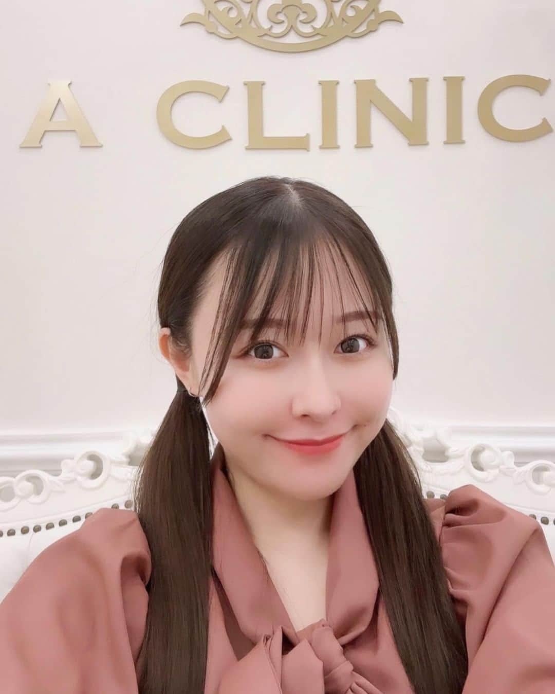 歩乃華（ほのらん）のインスタグラム：「🥰🥰 . @a_clinic_ginza の 加藤先生 @aclinic_katoh に 《Aスレッド》して頂きました🥰 顔しゅってしてめっちゃ嬉しいです💖 ありがとうございました😭 . 周りの友達も行ってる子多くて またAスレッドを受けました🥺 . フェラインがアプリ使った顔みたいなになる🥰 . クリニックお姉さん達対応も丁寧で素敵でした😢 内装も可愛いクリニックでした😭💖 . また定期的にAスレッド受けたい😞💓 詳しくはHP観てね🎈  #aスレッド #糸リフト #aclinic #aclinic銀座 #aclinic横浜 #aclinic新宿 #aクリニック #エークリニック#美容 #小顔 #美肌 #リフトアップ #美容外科 #美容皮膚科 #美容クリニック  #たるみ改善 #aclinic大阪 #aclinic名古屋 #aclinic福岡 #aclinic池袋 #加藤礼子」
