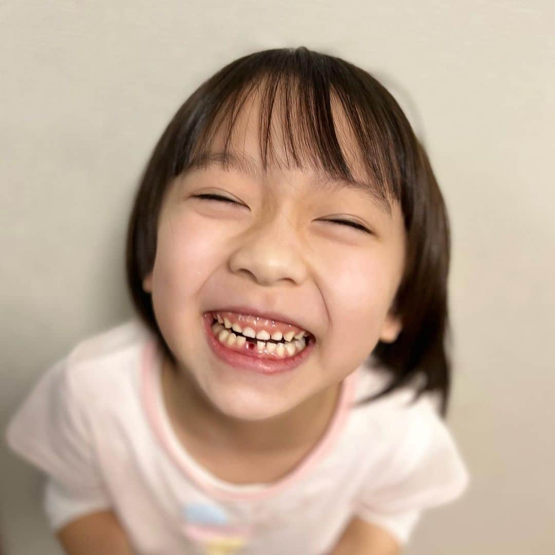 ゆうひなたのインスタグラム：「. . . 朝起きると ママー!歯抜けるかもー！！と 大興奮ゆうひさん（笑）. . . 無理やり抜きたくは無いらしく 自然に抜けるのを待ってみました☺️. . . ２日経つとだいぶぐらぐらしてきて そろそろ引っこ抜いてみたら？と 言ってみるもやっぱり怖いゆうひさん😂. . . 明らかにもう、スッ!と抜けそうな ぐらぐらだったので おかんがスポッ！と抜きました😂. . . 案外すぐ抜けたので 泣かずに大喜びしてたゆうひさん😂 ハイテンションで踊っておりましたww. . . おかんの時代は歯が抜けたら 外で上から下に投げてたのに 今の時代は歯を枕の下に置いて 歯の妖精さんがコインに変えるのを 待つらしいです🧚. . . 無事歯の妖精さんが来たらしいんだけど、、 （この歯どうしたらいい？😂）. . . 歯をまめに全部置いてる人も いるみたいだけども、、、 その歯を大人になった時に渡すの？🥹 歯いる、、？. . . と悩んでいるおかんです。（笑） . . . .」