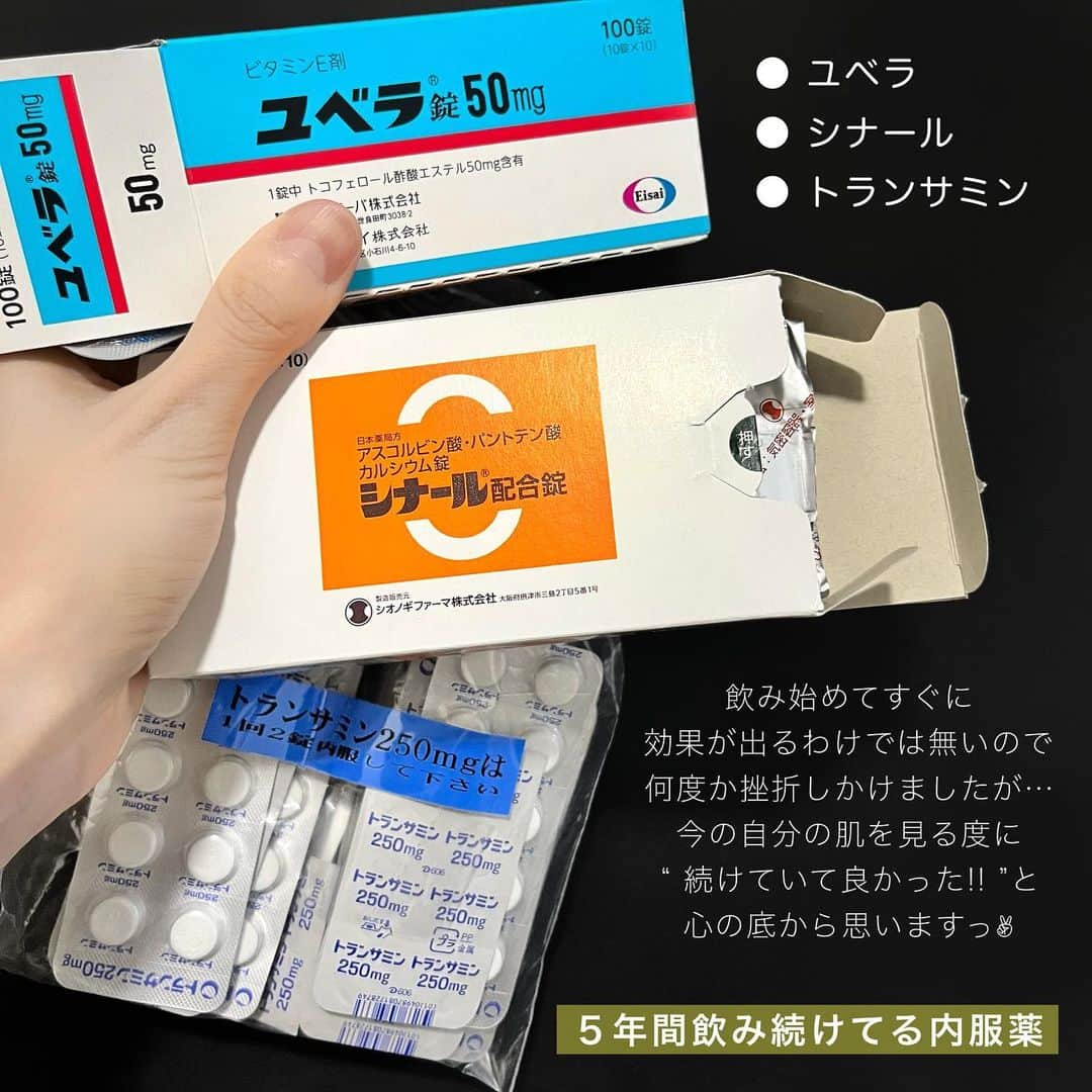 R E R Eのインスタグラム：「５年間飲み続けている内服薬💊  毎日欠かせない。 内側からのケア、大切  【 ユベラ 】 • 肌の代謝を良くしてターンオーバーを促進 • 紫外線などのダメージから守る  【 トラネキサム酸 】 • シミを出来にくくする • 出来ているシミを薄くする • 美白効果  【 シナール 】 • 色素沈着の緩和 • 肌の調子を良くする  継続して飲み続ける事が大事✌🏻💊 気が付けば、５年も飲み続けてる。  しっかり飲み続けてると 「肌キレイだね☺️」と言われる回数が爆増するし、 毎朝 鏡を見て、 「あれ！今日肌の調子めちゃ良いやん🥹✨」 って、ウキウキする日が増えます😙💓  私は、この内服ちゃん達のお陰で 今ノーファンデ生活を送れているようなもんです。 感謝感謝〜🙏🏻  美容＝継続  これはマジ。 . . . .  #美容#浜松#浜松市#肌質改善#スキンケア#美肌」