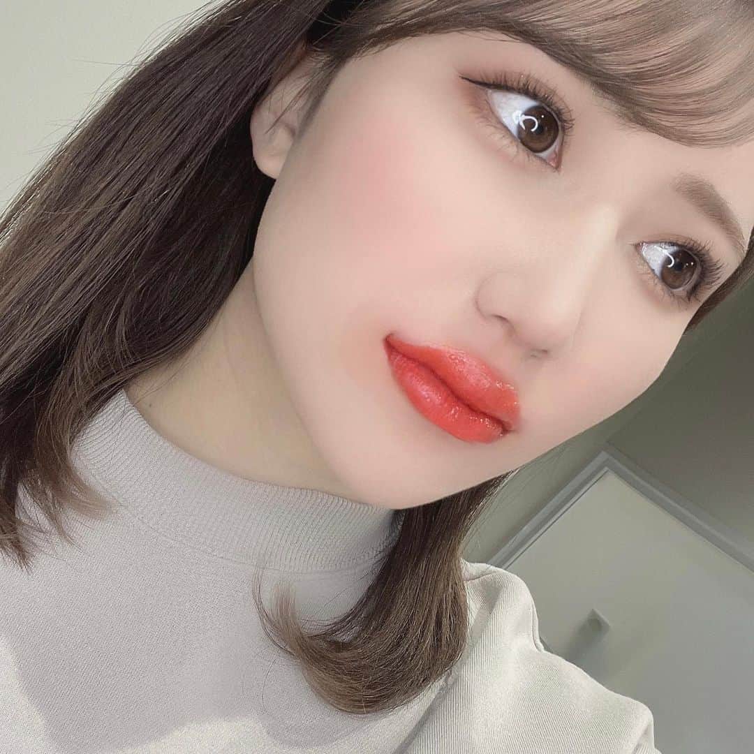 西澤瑠莉奈のインスタグラム：「． ． リップを塗ってもすぐ取れてしまうし スッピンの時に唇に色味がないのが気になっていたので リップアートに挑戦してみました〜！ ． 写真は色入れたて&ダウンタイムで かなりファビュラスな状態😂💋 今は腫れも落ち着いて、いつも通りのサイズ感 あとはかさぶたが取れて、色味落ち着き待ち…✨ ． いろんなカラーのリップを塗る楽しみがなくならないように 自然な色味に仕上がる予定💗 ． 勝村先生にお願いしました💕 希望や色味など細かく聞いてくださって安心感ある☺️ ． #リップアート #リップアートメイク #大阪 #淀屋橋  #美容 #メイク #リップ #痛くないリップアート #歯医者 #美容皮膚科専門」