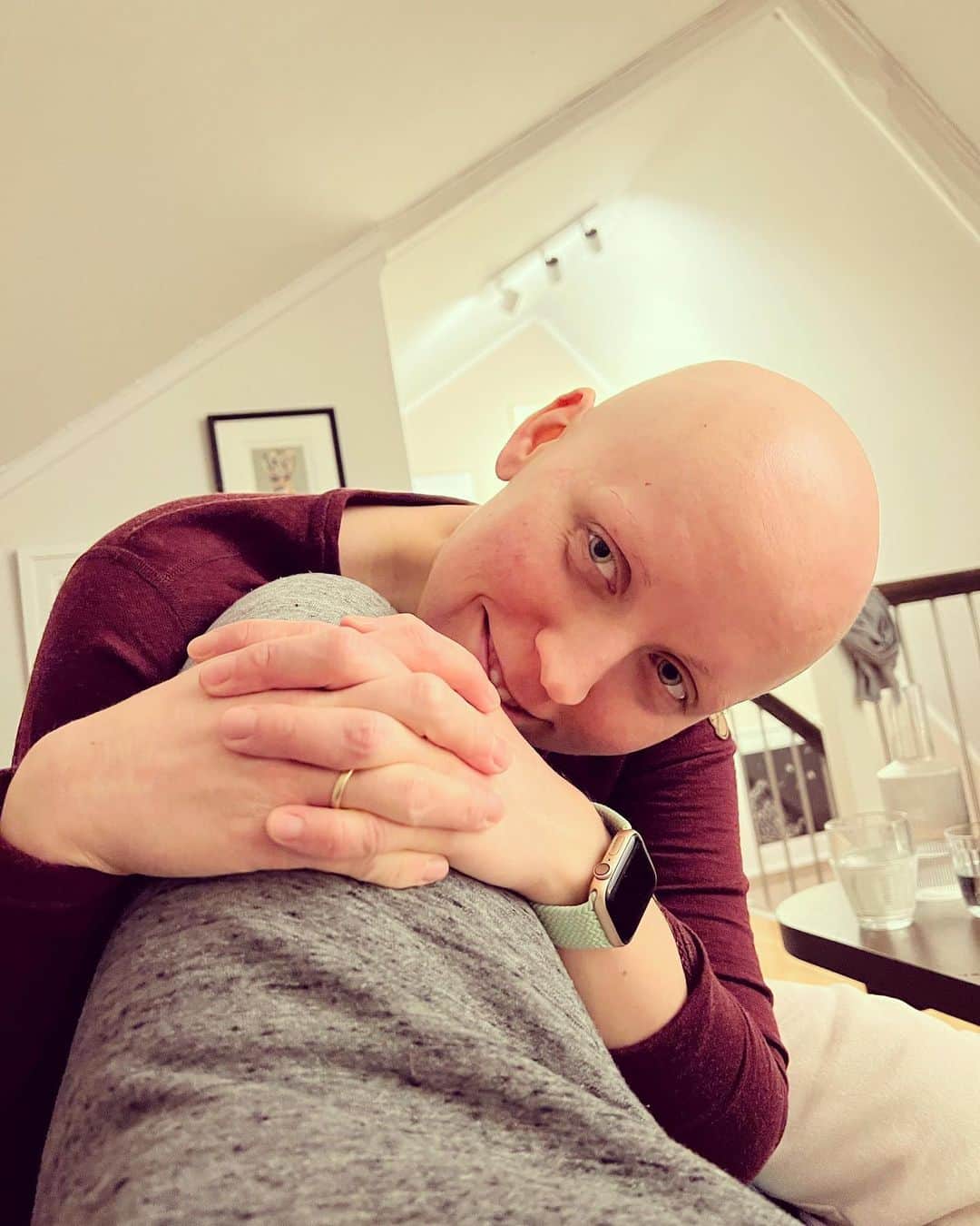 ティーネ・ティング・ヘルセットのインスタグラム：「What a difference a year make… Today is World Cancer Day ❤️ Here is a photo of me 1 year ago at home on the sofa. Swipe right to today with a cannoli in Palermo before playing with @orchestrasinfonicasiciliana this evening. It’s hard to explain how incredibly grateful I am to the doctors and nurses that made me feel safe the last year. Tonight I played for you 😍 @kreftforeningen #worldcancerday  #verdenskreftdag」