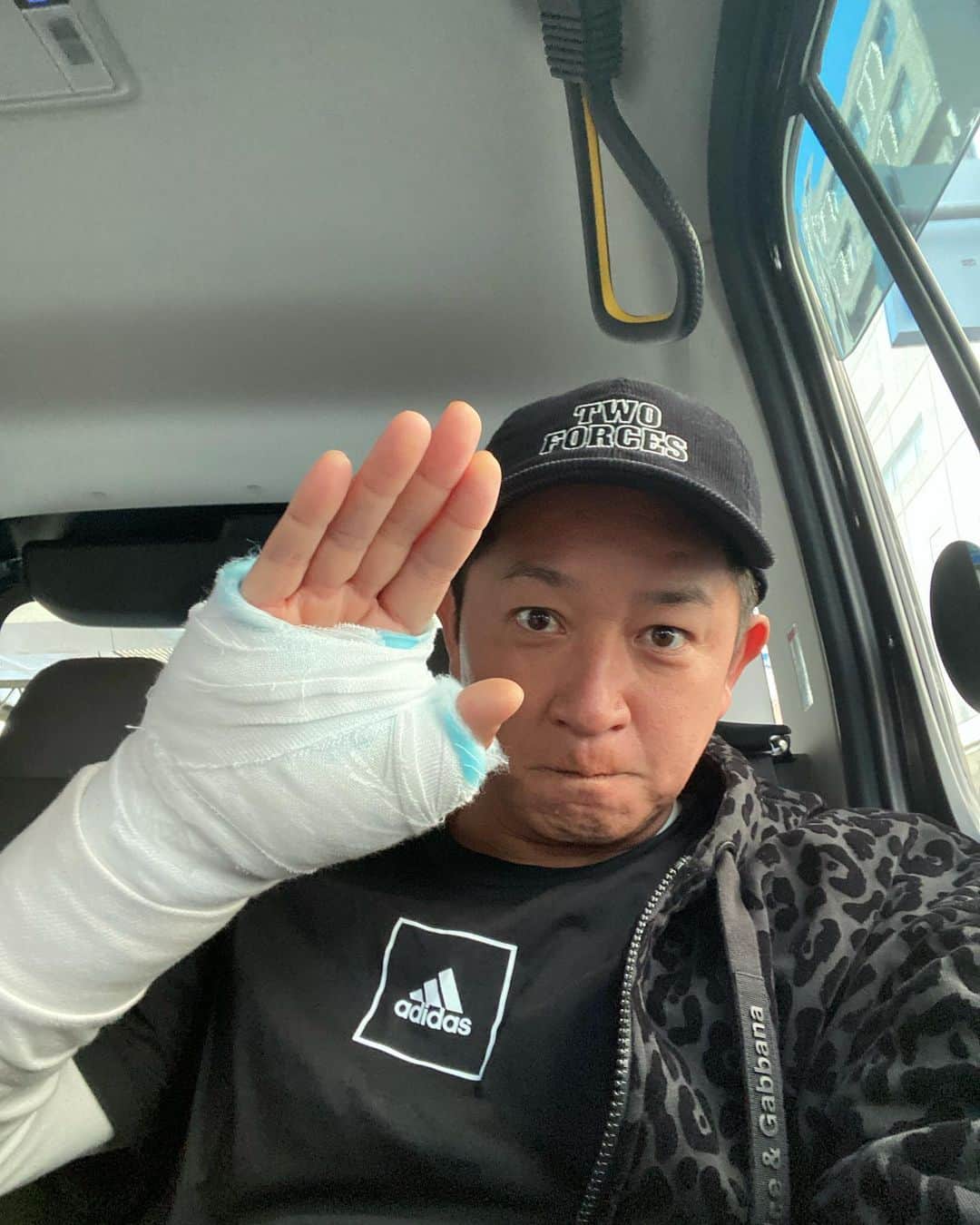 川島慶三のインスタグラム：「脱臼骨折 選手じゃないのにまだ怪我するか！ 野球っちゃ油断ならんな！ みんなも怪我には気をつけましょう！ チームに迷惑かけますが早く戻られるようにします⚾️  #骨折」