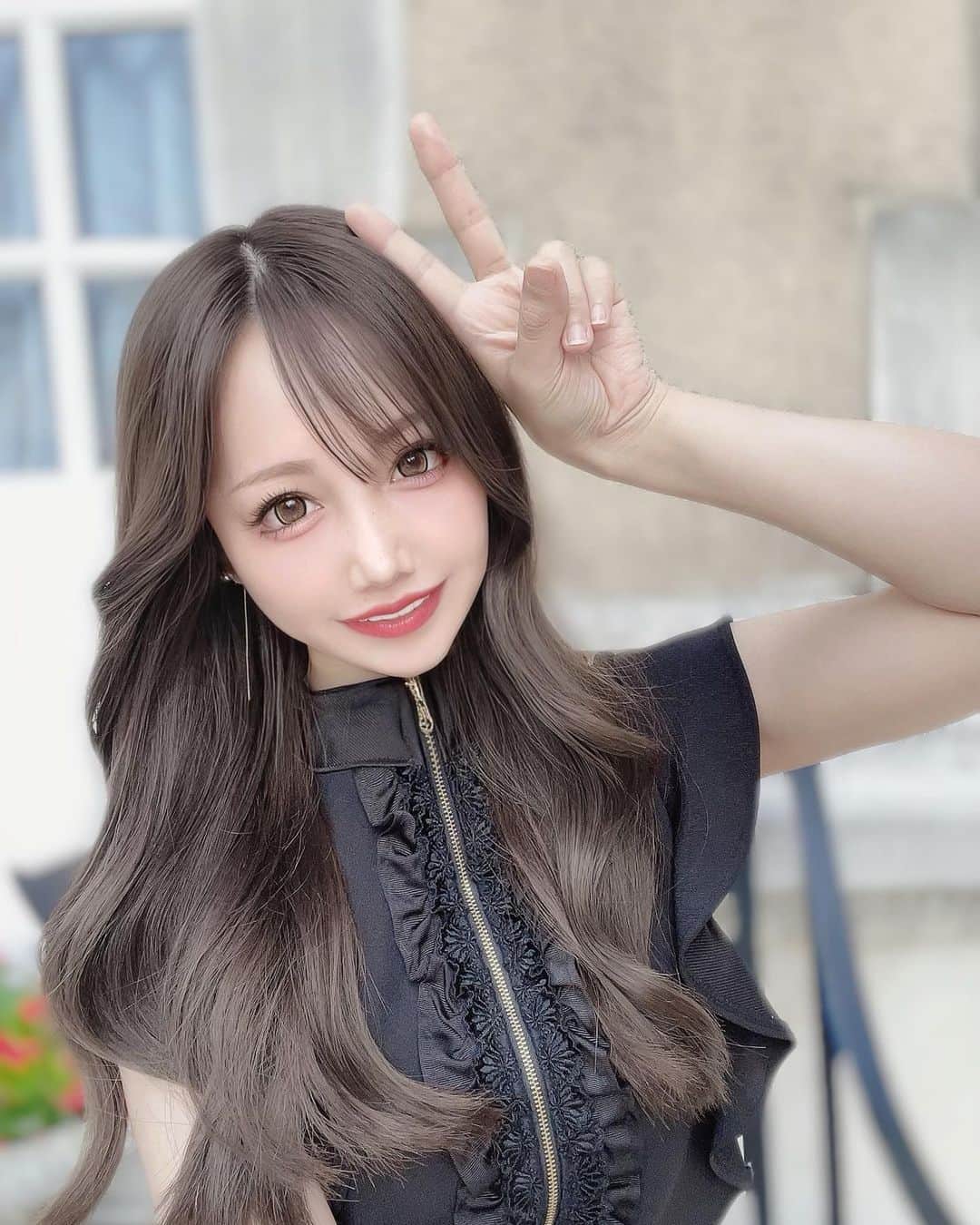 ひよこ先輩のインスタグラム：「ストーリーにも毎日のすっぴんの経過を 載せてたから知ってるかもやけど 投稿にもクマ治療について書くね☺️✨ 経過はストーリーで載せていってます🙆‍♀️  正面から見た時は目立たないんだけど すっぴんの時とか、上向いたり 斜めから見た時とかにクマ気になってて 色んな所にクマ治療のカウンセリング個人的に 行ってたのだが友達が( @xclinic_ebisu )でしてて めちゃくちゃ綺麗にクマなくなってたから 私も同じ井上先生( @dr_inouet_xclinic )にお願いした🥰 . 脱脂だけやと、数ヶ月したら凹んだり またクマ出来る可能性あるかもやから 目の下の脂肪注入のセットが仕上がりが 綺麗になるとの事だったから 二の腕の脂肪吸引して目の下に入れてもらった🥰 脂肪取ったついでにほうれい線と頬の凹みにも🙆‍♀️✨ まだ5日目なのだがすでにめちゃくちゃいい感じすぎて ダウンタイムもこんなに短いの凄くて 感動してる😭👏 クマがスッキリするだけで目元明るくなる🥺✨ また分かりやすい経過や内容は ストーリーに後日まとめます(`･ω･´) @xclinic_ebisu  @dr_son_shunichiro  @dr_inouet_xclinic  . #xclinic #xクリニック　#恵比寿 #クマ治療　#クマ取り」