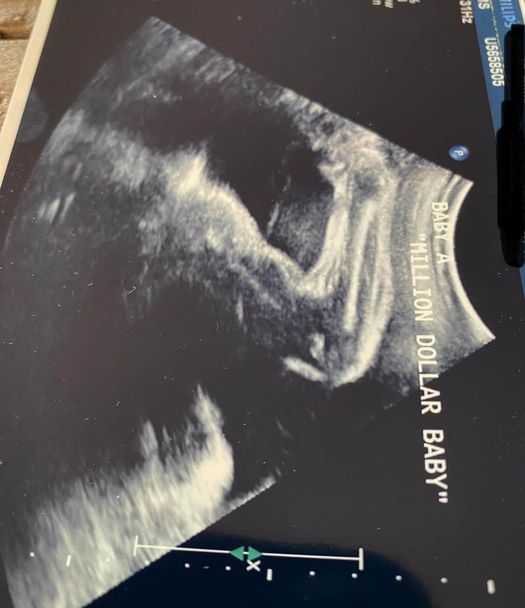 ヒラリー・スワンクのインスタグラム：「Baby A flexing for the camera at their ultrasound. 💪🏽🤣 #TheRealMillionDollarBaby #Prizefighter」