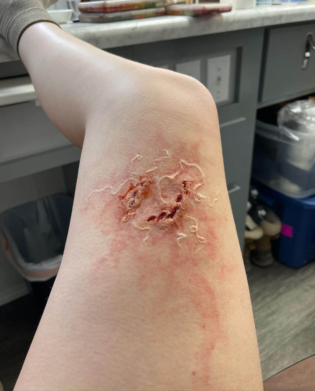 アシュレー・ジョンソンさんのインスタグラム写真 - (アシュレー・ジョンソンInstagram)「Bellie. Bite progression tests. Anna.」3月16日 13時15分 - ashleythejohnson