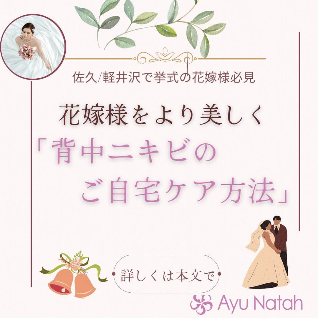【公式】ブライダルエステサロンのインスタグラム：「\3ヶ月で理想の花嫁様に変身/ お背中にできたニキビやニキビ跡でお悩みの花嫁様もいらっしゃいます  せっかくのご結婚式や撮影ですから 背中があいたドレスを自信をもって着たいですよね😄  ご自宅でのセルフケアもとっても大切ですから お背中ニキビでお悩みの花嫁様は必見です✨✨✨  🔷お体の洗い方🔷 ※ブラシやナイロンタオルをご使用中の方は 今日から手洗いに変えましょう  ※体を洗う時の強さはとにかく優しくです  ※お風呂上りはたっぷりの保湿を行いましょうこれからの季節ですと油分が少なめのボディミルクがおすすめ  最近は、花嫁様方に背中の洗い方を伺うと 手洗いの方も増えてきましたが ニキビが出来ると脂をきれいにしないと！という気持ちになる花嫁様がいるためかなりの強さでゴシゴシ洗いをされている方がいます😭😭  そのゴシゴシ洗いがのちに色素沈着を招きやすくなるためお気を付けください💦💦  🔷食生活も重要🔷 ※脂質や糖質は控えて、野菜を多くしたバランスのよい食事  ※ビタミン群の摂取も必須です！  🔷生活習慣🔷 ※ストレスを溜め込まない  ※質の良い睡眠をとる  ご自宅ケアでもなかなか 背中ニキビが落ち着かない方は サロンにご相談くださいね🥰  アユナタで ご自分史上最高に綺麗な状態で お式を迎えましょう🥰  ・ ・ ✳︎——————————————————✳︎  ブライダルエステサロン　アユナタ 長野県佐久市佐久平駅南１４－６　新日本ビル２F TEL : 0267-65-7211 営業時間 : 10時から20時まで （最終ご予約19時） 定休日 : 毎週火曜日  ⁡アユナタは完全予約制です。 あなた様のための最高のお時間を ご用意します♡ はじめての方はトライアルコースで ご予約くださいね ご相談、無料カウンセリングの お問合せもDMからお気軽にどうぞ ✳︎——————————————————✳︎ ＃背中ニキビ　＃産後ケア ＃背中ニキビの治し方 ＃ドレスをキレイに着たい　＃軽井沢婚 ＃結婚式まで痩せたい　 ＃ブライダルエステ ＃佐久市　エステ ＃佐久市エステ ＃佐久ブライダルエステ ＃佐久市ブライダルエステ」