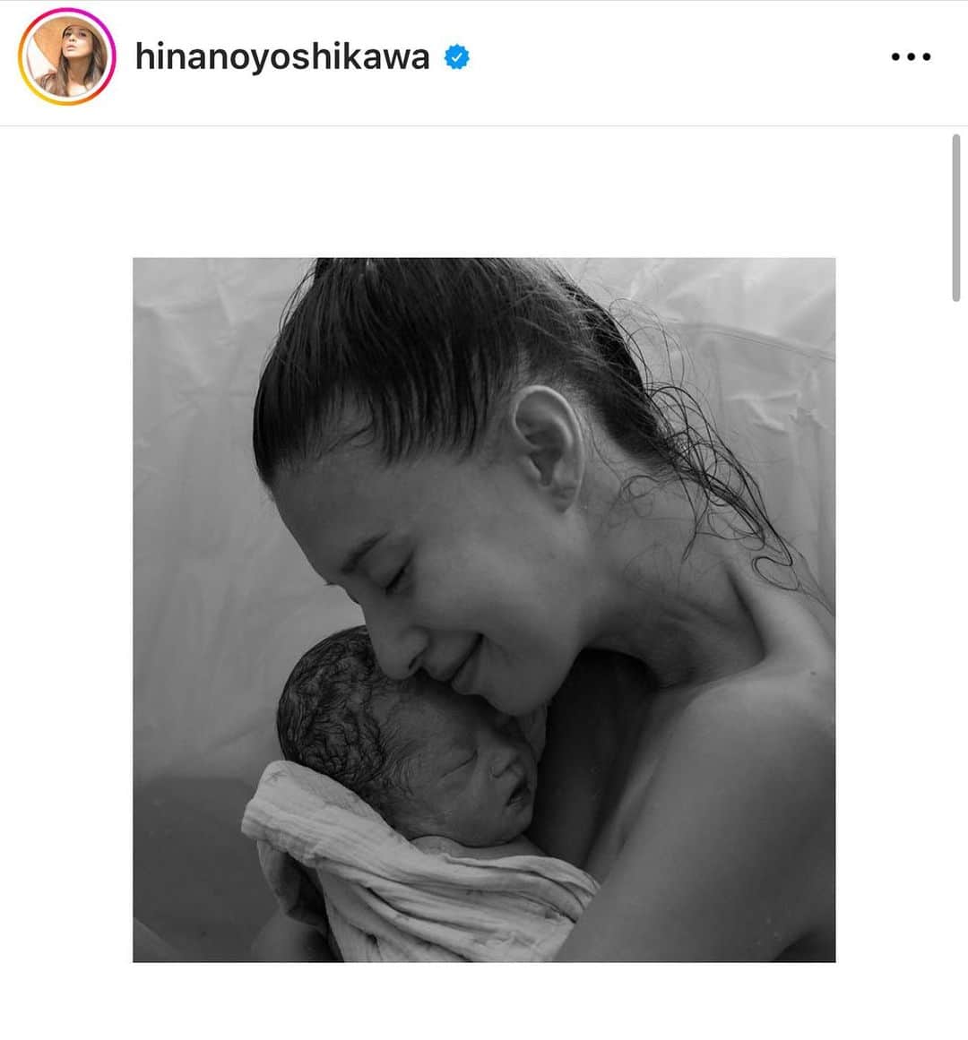 YOPPYのインスタグラム：「. あたしが芸能人になった時 ひなのちゃんに会えて　 お友達になって欲しいって 言ってお友達になってもらった 大切なお友達  お友達は いつも遥かに　軽々とあたしを超えた考え方をしていて 正直ついていかれへん様な存在  出産に関してもそう  調べ過ぎた知識と 自分と向き合い 特進出来るのであれば 出来る方法を 彼女はとても知り尽くしており もちろん 想定外もあると思うけど その想定外でさえも想定内として考えているみたい  女性にとっての命懸けの 大仕事  出産は法律で決め事を作られるような出来事ではないとおもう  認め合える世の中を目指したい  ひなのちゃん尊敬してる人間あたし  色々考えた結果 あたしは署名します  右向け右ではないのだから 心に従え~~~~~」