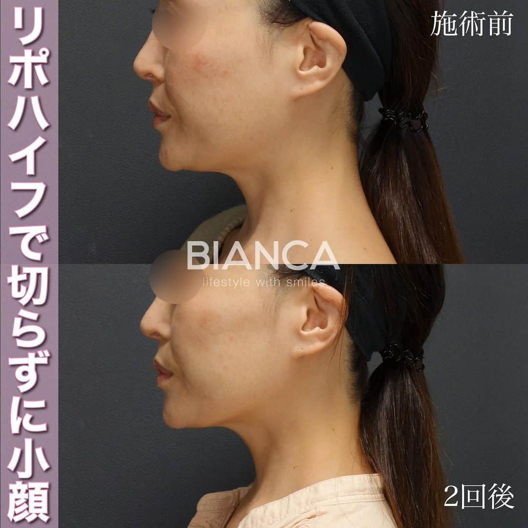 辻沢由有（BIANCA CLNIC 表参道院 院長）のインスタグラム