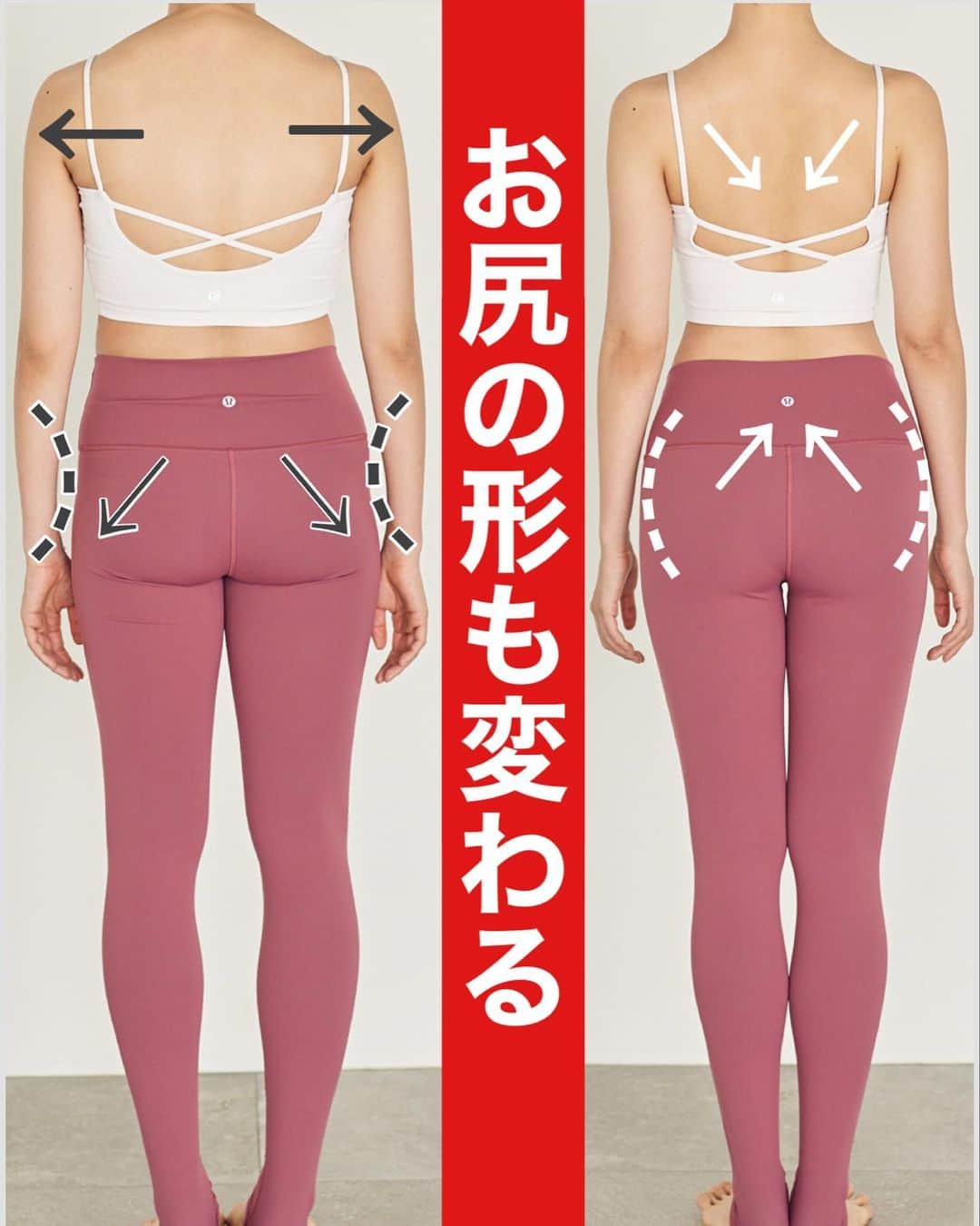 佐川裕香さんのインスタグラム写真 - (佐川裕香Instagram)「左→スウェイバック姿勢、右→よい姿勢  同じ体重、人でも見た目からだの負担も変わります！  姿勢は、形ではなく環境や動きの中で変化🌍  そのために骨のズレ、捻れを少しずつ修正 使いすぎてしまった筋肉を緩め 本来、しっかり働くべき筋肉を自然と使えるような構造に全身で変えていく✨  重力を味方に変えると お尻の形も変化していきます🦶✨  --------------------------------------------------  残り1日‼️  \月額オンラインレッスンお申込み受付け/  ▶︎募集期間 →3/4(土)23:59まで‼️  プロフィールのURL、MOSHサイトから お申込み受付けさせて頂きます✨🌸  I begin the online lesson of the monthly basis system that I turned toward the world in few days! I am looking forward to what I can give lessons in together!🌍  --------------------------------------------  \お知らせ/ ●通常5週目はお休みですが 3月29日(水)『足・脚・整える✨』 特別レッスンを開催いたします！！  とても大切な内容となっております🌱 この機会にぜひ✨  @ufix_world   --------------------------------------------」3月2日 19時32分 - yuuka_08