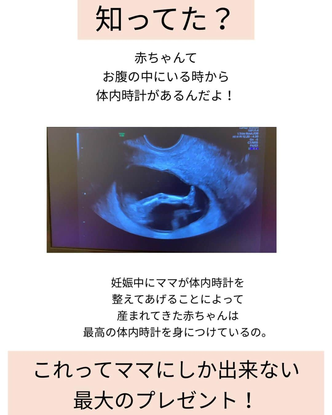 美優さんのインスタグラム写真 - (美優Instagram)「知ってましたか？？ 赤ちゃんの体内時計は お母さんのお腹の中にいる時から 作られ始めているんですよ！☺️  この体内時計をどのような状態で持って生まれてくるか…で赤ちゃんの睡眠が変わってくるのです！  妊娠中に最高の体内時計を持たせてあげることで、産後のママにも良いことがたくさん😆  goosleeでは大人の睡眠コース以外に赤ちゃんとママの為の睡眠コースもご用意しています☺️  妊娠中からでも大丈夫ですし、 産後いつからでも大丈夫です！  まずは体験カウンセリングにお申し込み頂き、課題・目標を決めさせていただき、本コースのスタートとなります！  ご興味がある方はホームページをご覧ください☺️✨  #gooslee #睡眠カウンセリング　#sleepカウンセラー　#セルフネンネ」3月5日 14時37分 - miyu11_20