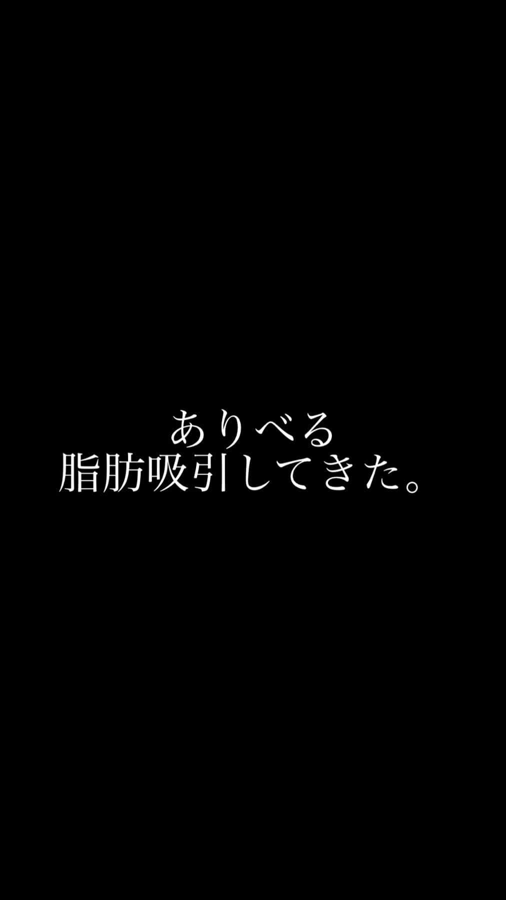 一色亜莉沙のインスタグラム：「#脂肪吸引 #脂肪吸引レポート #脂肪吸引ダウンタイム #産後ダイエット #産後太り #美容外科 #モッズクリニック　#脂肪吸引専門　#脂肪吸引やってみた　#ダイエット宣言 #ダイエットママ」