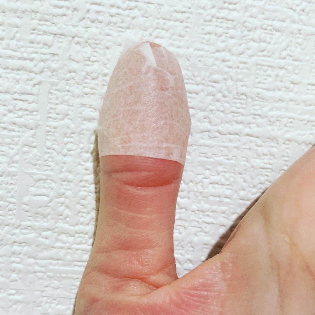 大迫深雪さんのインスタグラム写真 - (大迫深雪Instagram)「あれから1ヶ月を超え、傷はすっかり治りました！ ですが…ずっと痛みが残っていて、時々激痛で。 整形外科に行きレントゲン撮ってもらいました💦 塗り薬をもらい2週間の安静（指のみ）をと😅 骨の修復待ちです💧 化膿したり、神経が損傷してなくてよかったです。」3月11日 22時10分 - m_y_k_888