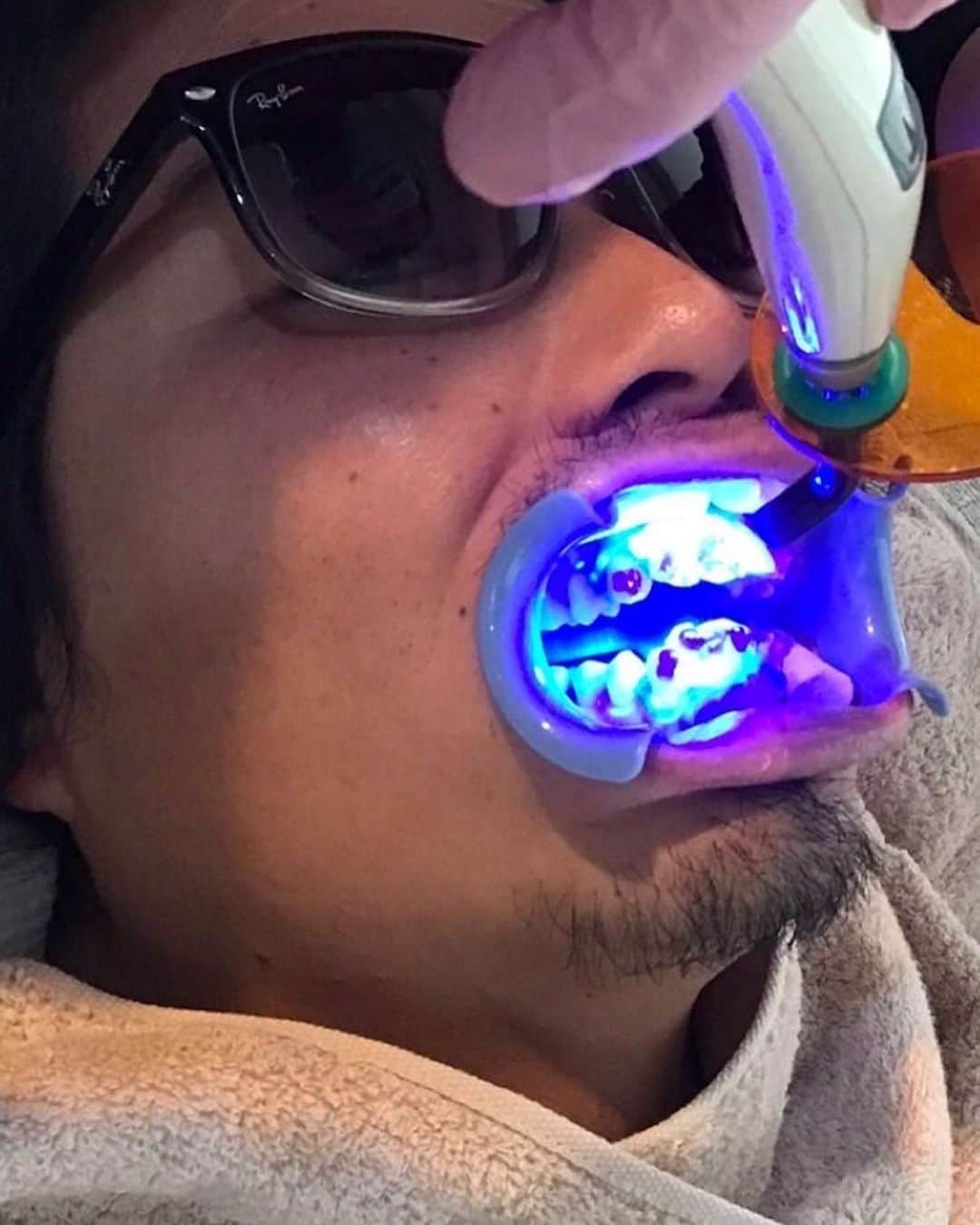 ジェイク・リーのインスタグラム：「Teeth Whitening Time🦷🦷🦷  #noah_glg」