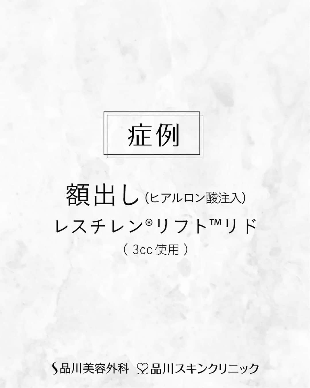 品川美容外科【公式】のインスタグラム