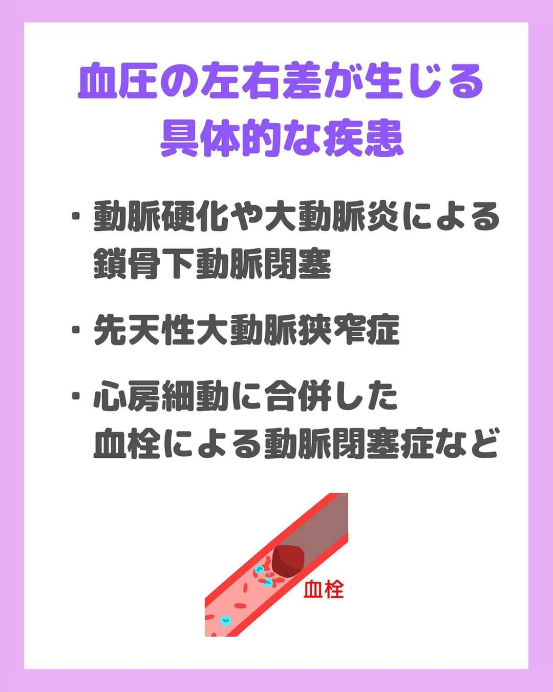 看護師ナスさんのインスタグラム写真 - (看護師ナスInstagram)「@nursenasunasu👈見なきゃ損する看護コンテンツもチェック！  どうも！看護師ナスです🍆  厳密には左腕より右腕の方が少しだけ血圧が高いのが一般的✨ 知っていましたか🤗？  ———————————————————————— ▼他の投稿もチェック🌿 @nursenasunasu  #看護師ナス #看護師と繋がりたい #看護師あるある #看護師 #ナース #看護師辞めたい #看護師やめたい #新人ナース #看護師転職 #看護師勉強垢 #看護 #看護学生  #看護学生の勉強垢  #血圧 #左右差」4月10日 19時35分 - nursenasunasu