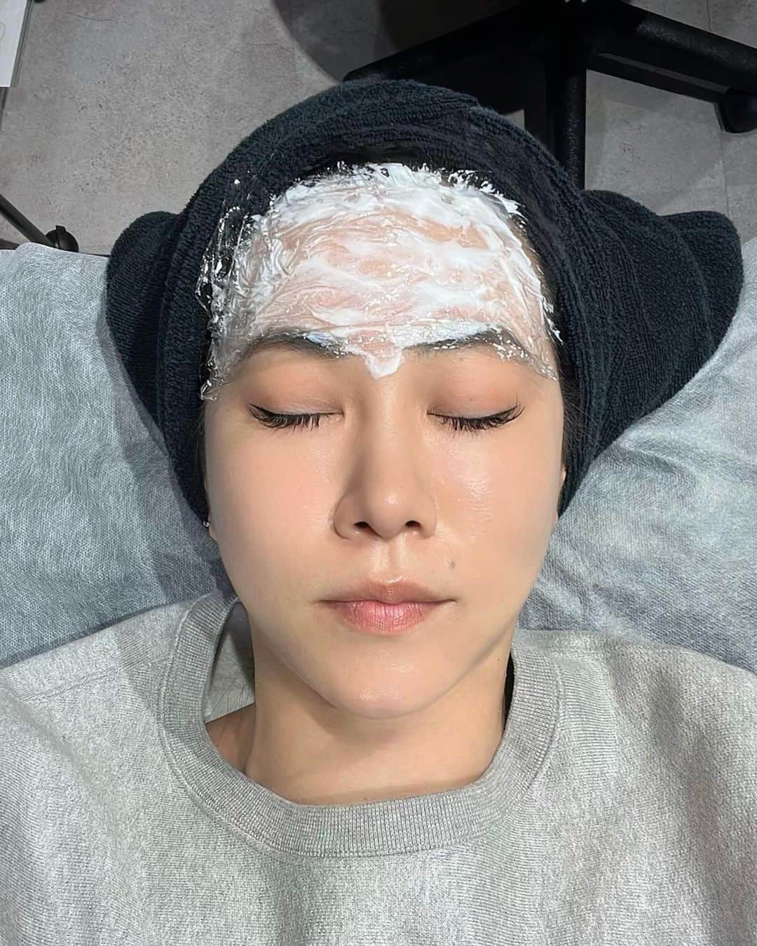 須田朱音さんのインスタグラム写真 - (須田朱音Instagram)「𝖠𝗋𝗍𝗅𝗈𝗎𝗇𝗀𝖾 𝖼𝗅𝗂𝗇𝗂𝖼.  先日、推し活前に信頼してる @dr.yoko_alc 先生にお任せして、 人生2度目の額ボトックスしてきました。  前回から、約7ヶ月ぶりかな？ 痛みに弱い私も麻酔クリームだけで大丈夫でした。  ダウンタイムもなし、目の重さや違和感もなく おでこつるつるになりました♡  元麻酔科医の陽子先生は注入とってもお上手なので、 悩んでる方はカウンセリングに行ってみてね‼︎  📍 @artlounge_clinic  #artlounge #artloungeclinic #ボトックス #アートラウンジクリニック」3月21日 17時46分 - akane_godo