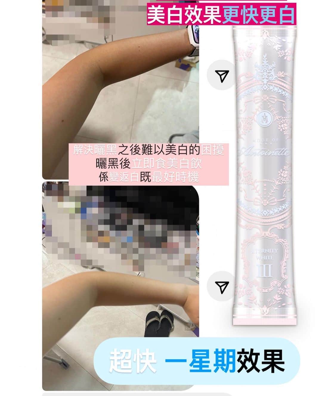 のインスタグラム：「曬黑後立即食美白飲  係變返白既最好時機 膚色色tone3級跳變白！  新美白飲套裝 美白飲56條+美肌丸+童顏丸$1721（原價$1912）  美白飲第三代第二批！ ⚜️ 𝙀𝙏𝙀𝙍𝙉𝙄𝙏𝙔 𝙒𝙃𝙄𝙏𝙀 Ⅲ ⚜️ ⚜️ MOA 袪斑極緻美白飲Ⅲ 新版第③代 ⚜  ⚜️150,000 條終於到貨 ⚜️第3代成份配方升級 ⚜️再添加新成份 共8種有效美白成分 ⚜️針對底層色素更滲透更有效 ⚜️處理淺層色素更快更明顯  從此不需要再用濾鏡，肌膚白裏透光，水感透白，再沒瑕疵。  美白產品一向只需成分上分析，含量及實際功效。 抗自由基：GliSODin®法國專利香瓜萃取 抗糖化：櫻花萃取 抗光老化 ：蕨類植物抽出物 抗黑色素沈積：L 半胱氨酸 、橄欖果提取物 抗色斑黃褐斑：梔子花取出的藏紅花酸、酵母提取物 抗暗沈氧化：谷胱甘肽  特別適合： ▫️追求美白與美肌兼顧的您 　 ▫️希望在炎夏得到美白護理的您 　 ▫️受膚色暗沈困擾的您 　 ▫️擔心出現色斑及雀斑的您　 ▫️由體內極速給予肌膚透明感  ▫️追求全身透亮美白的您 ▫️不適合使用外用美白產品的您 ▫️一般美白丸已不能滿足到的您 ▫️曬黑之後難以回復原狀的您  🇯🇵日本製  ⚜️MOA 貴婦奢華系列⚜️ ⚜️袪斑極緻美白飲Ⅲ 第三代⚜️ 紅茶味 ⚜️$672/28條  ⚜️$3185/168條 （79折）平均$531一盒   ⚜️MOA 育成淨白發光肌組合 ⚜️ ⚜️ 袪斑極緻美白飲 + 全效嫩滑透亮美肌丸 ⚜️3盒美白飲+ 3包美肌丸=$2456（87折） ⚜️5盒美白飲 + 5包 美肌丸=$3764（8折）  ⚜️MOA 育成嬰兒白滑肌組合 ⚜️ ⚜️ 袪斑極緻美白飲 + MOA嬰兒童顏丸 ⚜️2盒美白飲+ 2包童顏丸 =$1748（9折） ⚜️5盒美白飲 + 5包 童顏丸 =$3884（8折）  #美白飲 #美白產品 #美白淡斑 #美白保濕 #美白飲」
