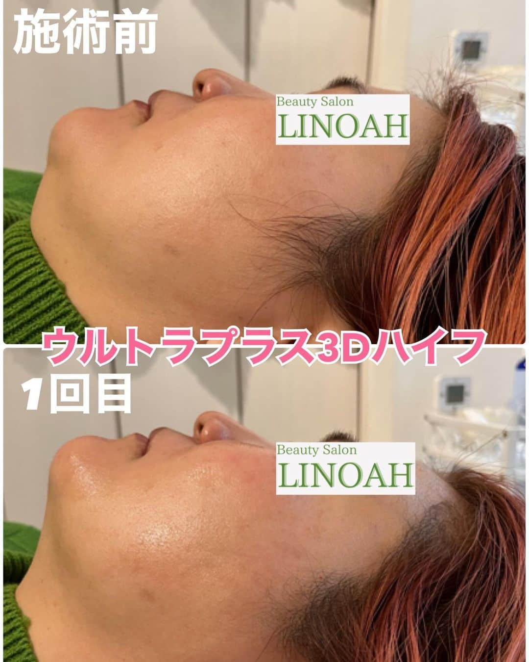 Beauty Salon LINOAHのインスタグラム