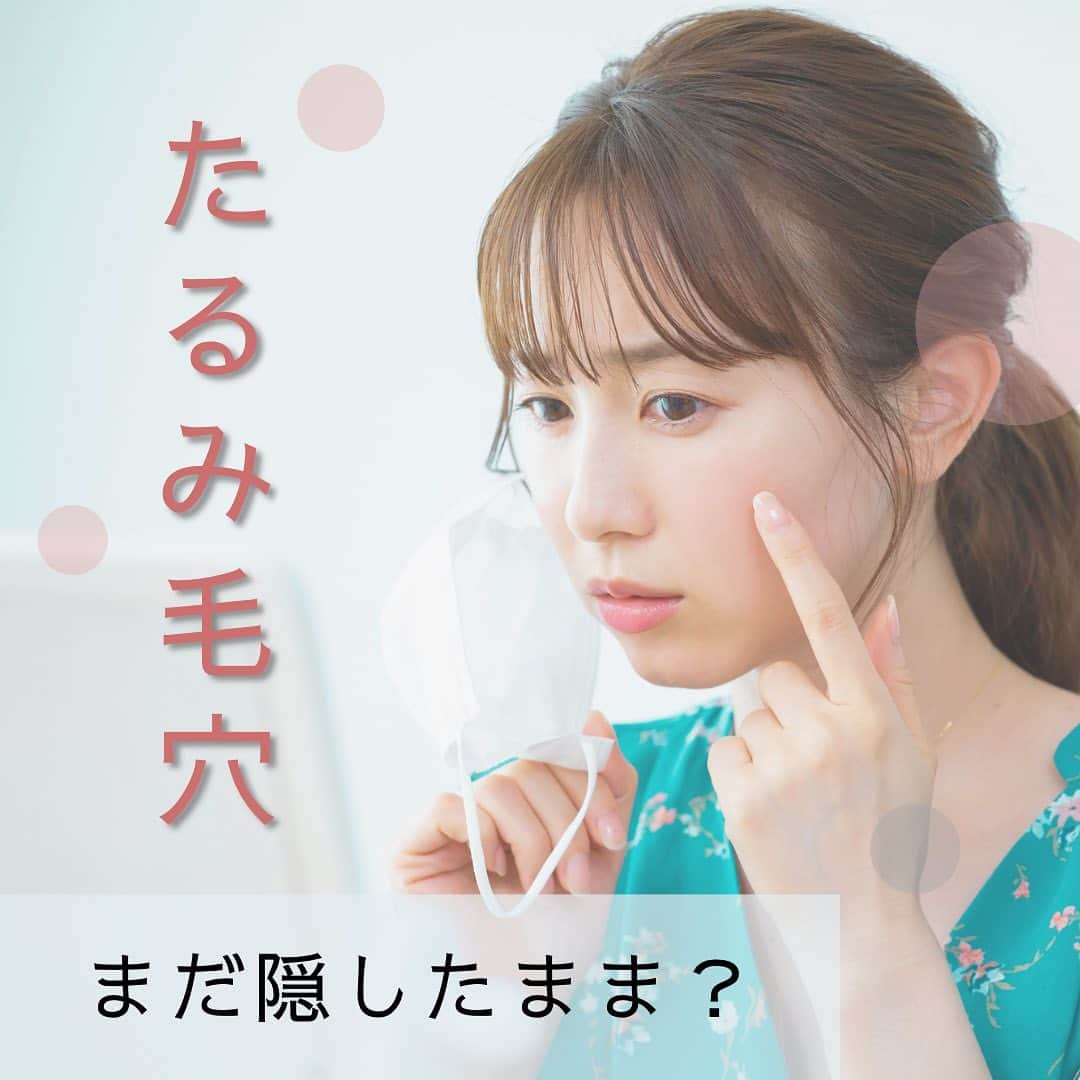vs28baliのインスタグラム：「いざ、マスクを外そうと思ったら… 頬の毛穴が気になりませんか？☹️  今まで隠れていたお悩み 今こそきちんとケアが必要です！  頬の毛穴が目立ってくる原因のひとつが「たるみ」😰  20代後半から30代にかけて、 だんだんと角質層の水分保持力が減少し始め 同時に肌内部のコラーゲンを作る力も 衰えてきます🙁  内側から支えるコラーゲンが 少なくなると毛穴はすり鉢状に広がり 大きく広がった毛穴が重力により 下へ引っ張られてしまいます☹️  そのため毛穴がしずく型になり 更に目立つようになるのです😱  ⚠️たるみ毛穴CHECK⚠️ 鏡で顔を見ながら、手で頬を包むようにして 軽く上に持ち上げてみてください❗️ その時の毛穴の状態をチェック🧐  毛穴が目立たなくなるようでしたら それは「たるみ毛穴」の可能性大です😭💦  顔の大部分を占める頬に たるみ毛穴が増えると 見た目の印象年齢がグッと 上がってしまいますので要注意です😰  💡たるみ毛穴は早めに対策を❗️ 黒ずみ毛穴や毛穴詰まりから起こる ニキビなどとは違い 汚れを落としたり皮脂を取り除くだけでは ケアしづらいのがたるみ毛穴。 顔全体のたるみも並行して起こっているので 予防するための継続的なケアが必要です👍  肌が乾燥して「しぼんだ」状態に ならないように しっかりと保湿ケアをすること 更に顔全体のたるみ対策として コラーゲンに働きかけるケアを 取り入れてみましょう😊  また、コラーゲン生成に欠かせない 成分であるビタミンＣは 肌の酸化を防ぎ、弾力やハリの元となるため 日々のスキンケアにオススメです✨  スキンケアスタジオでもたるみ対策ケアや コラーゲン＆ビタミンC配合の化粧品を 多数ご用意しております👍  基礎化粧品会社だからこそできる 美肌づくりのプロのケアを 是非一度お試しください♪ . . スキンケアスタジオへのご予約・ 公式オンラインショップは プロフィールのリンクからCHECK🔍 . . #たるみ毛穴 #ビタミンC #コラーゲン #乾燥 #シミ #シワ #ニキビ #毛穴の汚れ #毛穴の黒ずみ #角質肥厚 #角質除去 #イービーエム #イービーエム化粧品 #スキンケア好きさんと繋がりたい #セルフケア #肌荒れケア  #マスクで肌荒れ #毛穴 #健康 #美容 #vs28bali #スキンケアスタジオ #ebm #フェイシャル #毛穴洗浄 #美肌 #小顔  @vs28bali @ebcc.skincarestudio @ebm_mandibali  @ebm_onlineshop」