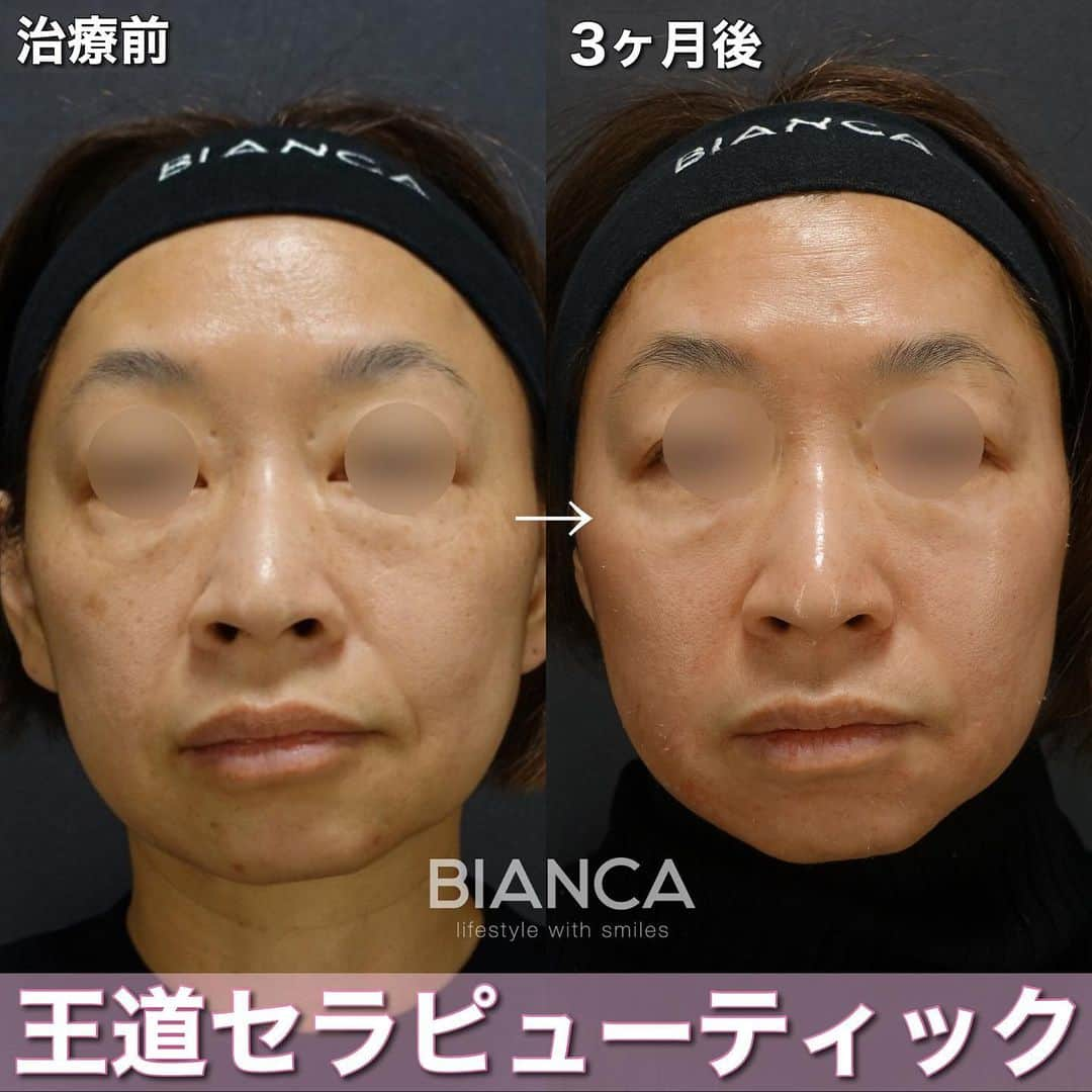 辻沢由有（BIANCA CLNIC 表参道院 院長）のインスタグラム