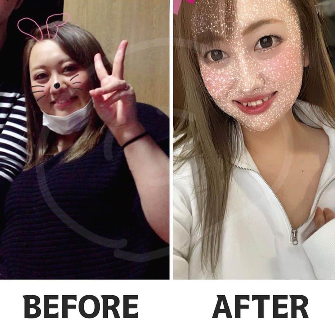 加藤ひなたのインスタグラム：「視聴者さんビフォーアフター🌸  89kgから65kgまで 期間は4ヶ月ほどで落としたよ！とメッセージくださいました😌✨✨ 　 トレーニングは2.3枚目に載せたよ❕ 変わるためと暇さえあればストイックにトレーニングは頑張ったよ〜って言ってたよ☺️  みんなのモチベになりますように✨  #トレーニング #筋トレ #ダイエット #diet #training #脚やせ #お腹痩せ」