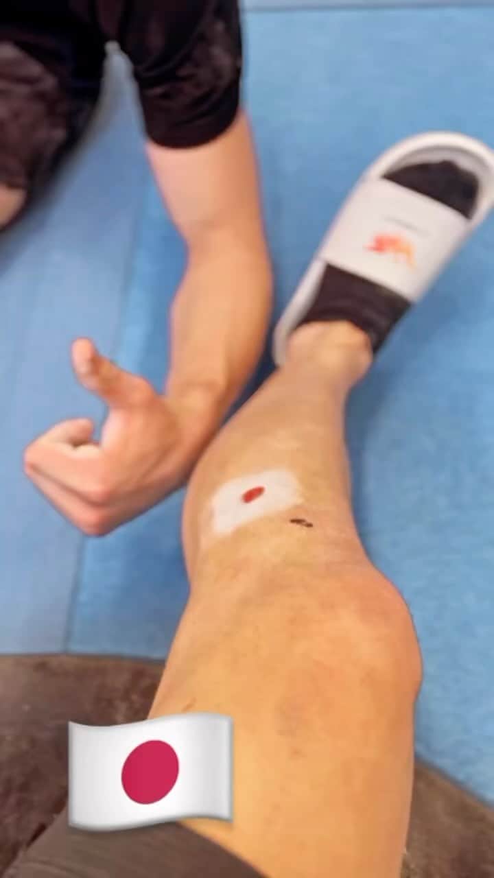 湯浅賢哉のインスタグラム：「脚の傷は体操選手の恥だ。  けど頑張った証でもあるね✌︎❤️‍🔥  #🇯🇵 #GYMNASTICS」