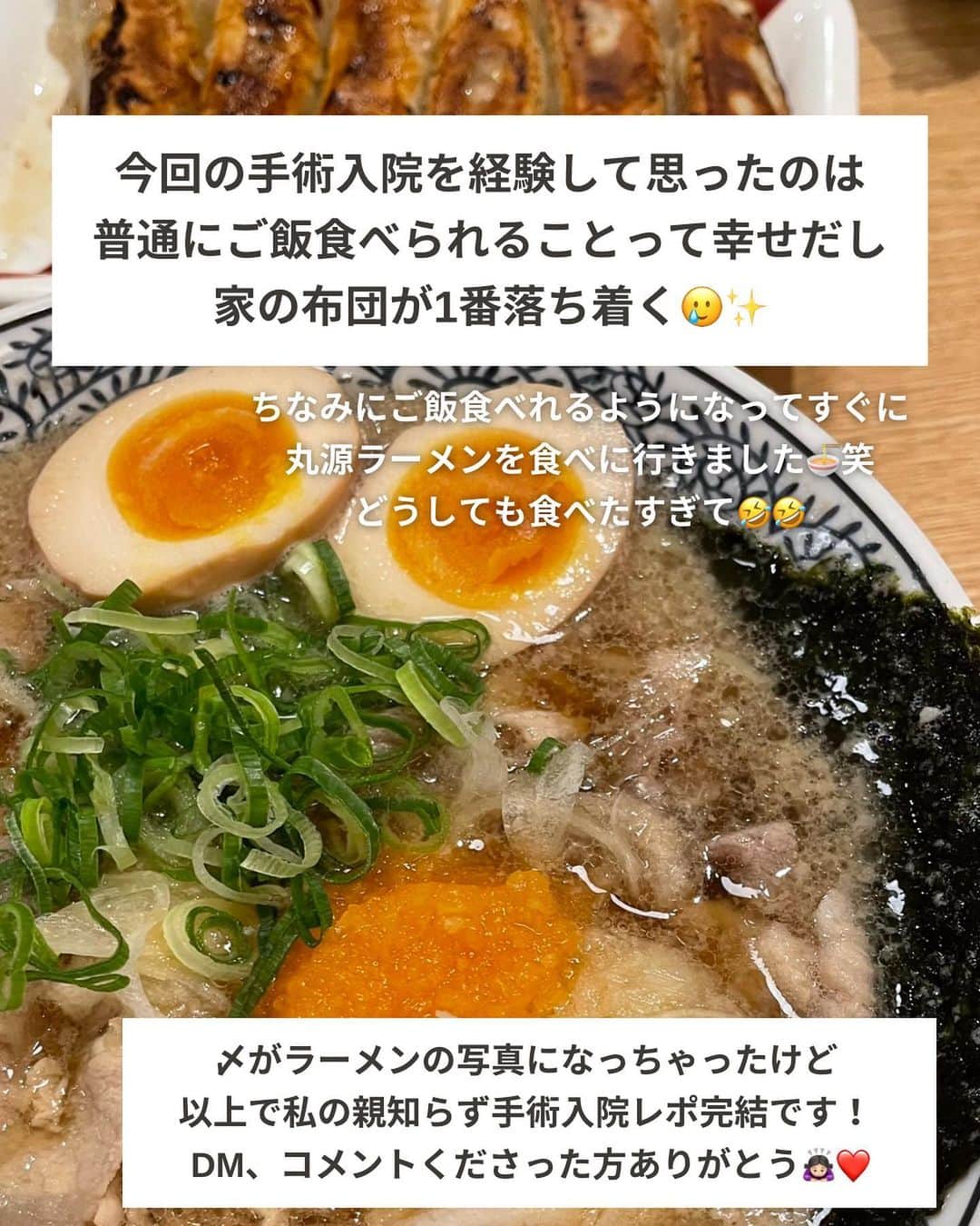 ゆきこさんのインスタグラム写真 - (ゆきこInstagram)「3月中旬に手術入院した話の続編...!!  例のカオパンマンな腫れは約1週間半で引いて元気に戻りました🙌←抜いたところの大きな穴は気になるけど💦  入院手術と同時に気になってたのが、医療保険の対象になるのかどうか🧐  調べみたら親知らずの手術だと入院日額は出たけど手術は対象外だったとか色々出てきて、果たして貰えるのか、、、？って不安なってたけど、私が加入してる医療保険は対象で手術給付分も振り込まれてました👏  それと抜歯で通った通院分も振り込まれててびっくり！←想定外 この後も何回か経過診察で行く予定なんだけど、通院対象になるんかな...？どうなんだろ🤨  今回、保険金が出たのは嬉しいけど、めちゃくちゃ痛かった＆腫れて不便な生活だったので二度と経験したくない！😂笑  普通にご飯が食べられて、家の布団で寝られる生活が1番だなと痛感しました😌❤️  これから親知らず手術予定の人は加入してる医療保険が対象かどうか事前に確認してみてください🙌✨  #親知らず#手術#入院#医療保険」3月31日 21時24分 - yuco55_