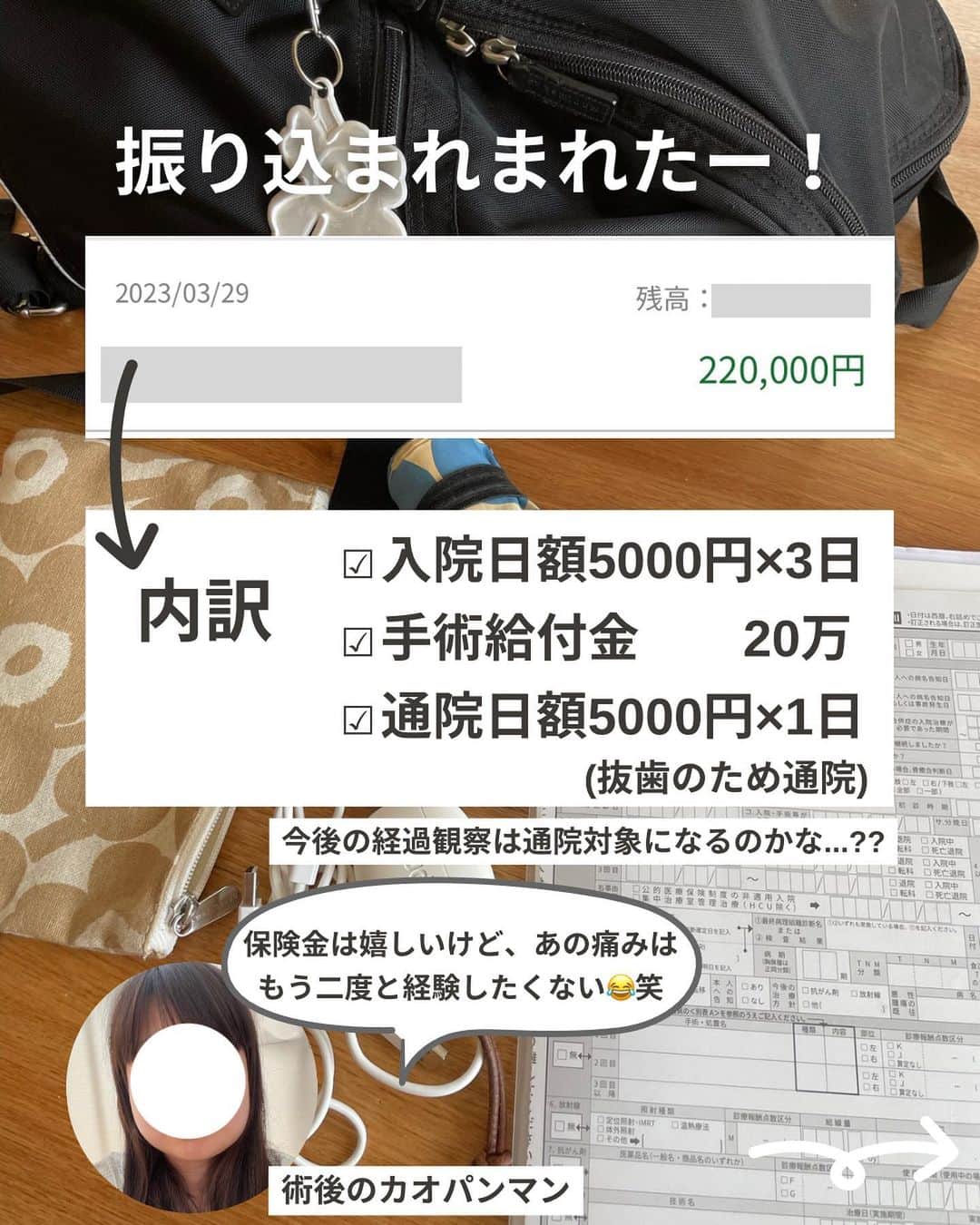 ゆきこさんのインスタグラム写真 - (ゆきこInstagram)「3月中旬に手術入院した話の続編...!!  例のカオパンマンな腫れは約1週間半で引いて元気に戻りました🙌←抜いたところの大きな穴は気になるけど💦  入院手術と同時に気になってたのが、医療保険の対象になるのかどうか🧐  調べみたら親知らずの手術だと入院日額は出たけど手術は対象外だったとか色々出てきて、果たして貰えるのか、、、？って不安なってたけど、私が加入してる医療保険は対象で手術給付分も振り込まれてました👏  それと抜歯で通った通院分も振り込まれててびっくり！←想定外 この後も何回か経過診察で行く予定なんだけど、通院対象になるんかな...？どうなんだろ🤨  今回、保険金が出たのは嬉しいけど、めちゃくちゃ痛かった＆腫れて不便な生活だったので二度と経験したくない！😂笑  普通にご飯が食べられて、家の布団で寝られる生活が1番だなと痛感しました😌❤️  これから親知らず手術予定の人は加入してる医療保険が対象かどうか事前に確認してみてください🙌✨  #親知らず#手術#入院#医療保険」3月31日 21時24分 - yuco55_