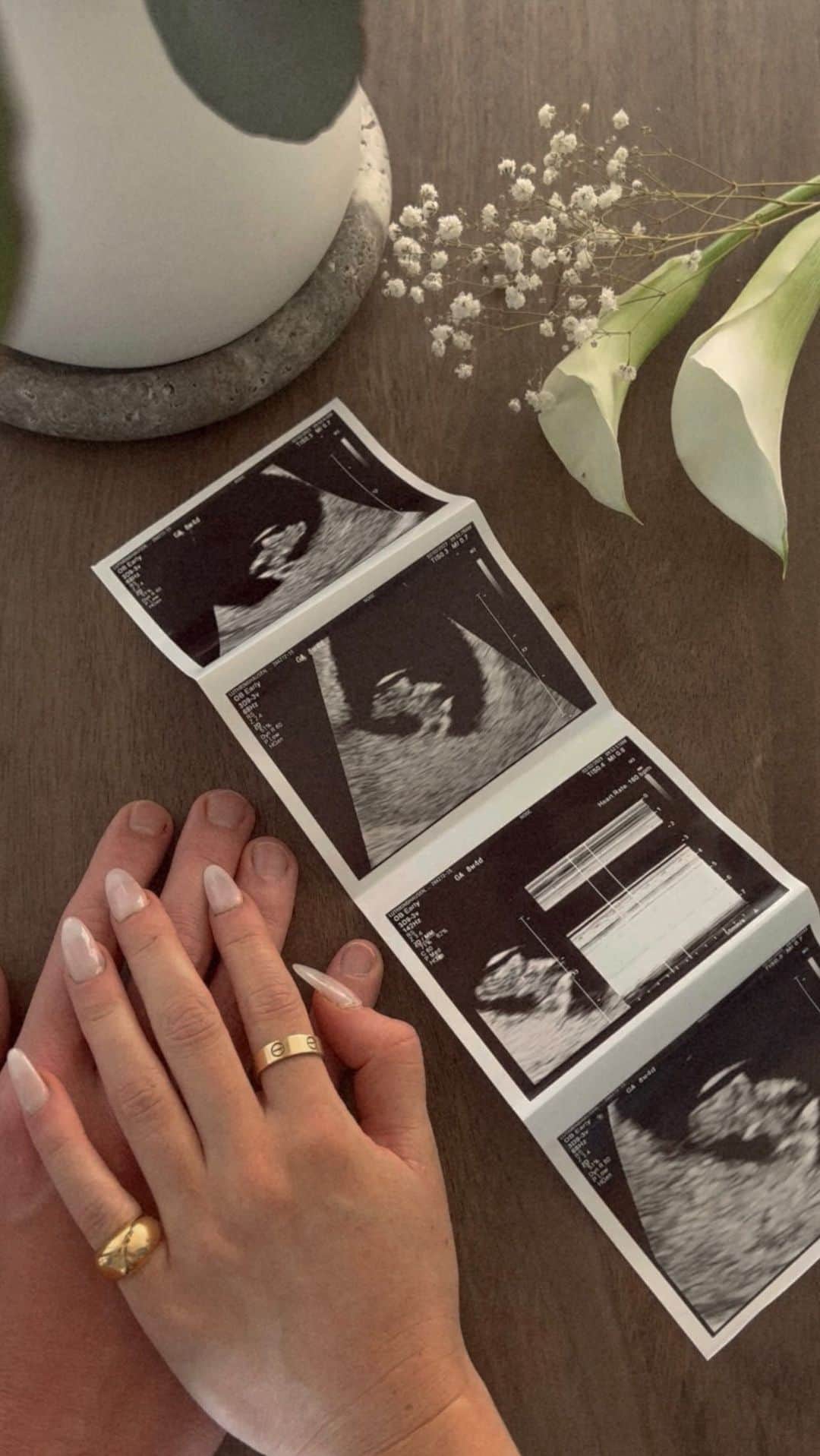 Lauren Elizabethのインスタグラム：「Been keeping a little secret all year 🤭 We are so excited for our baby girl this September 💕🌸🌷 First trimester vlog is on my YouTube 🎞️」