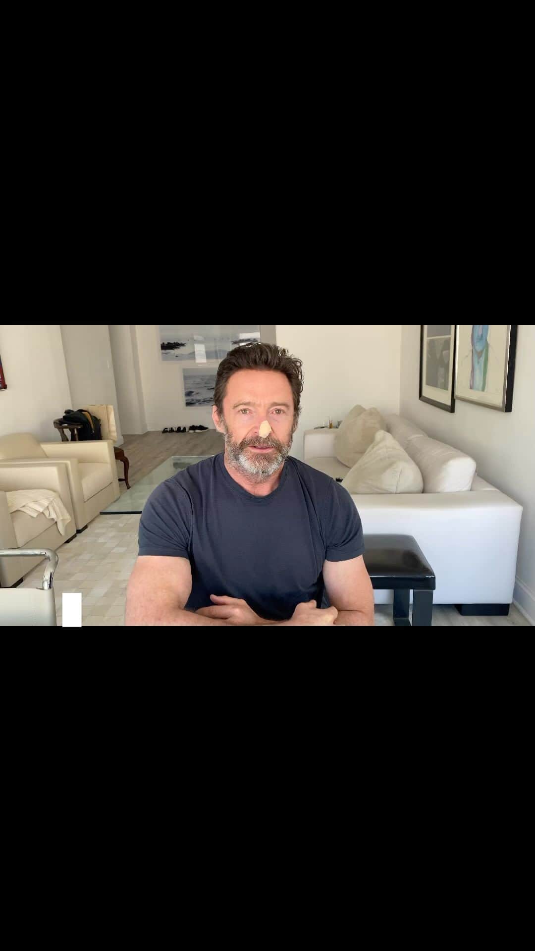 ヒュー・ジャックマンのインスタグラム：「I know you’ve heard me talk about my basal cell carcinomas before. I’m going to keep talking about them, if need be. And if it reminds even one person to put on sunscreen with a high SPF, then I’m happy.」