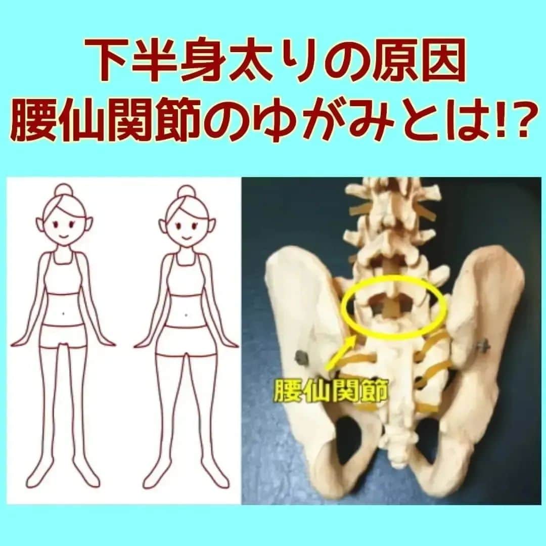 中目黒整体レメディオ 院長　渡邉潤一のインスタグラム：「多くの下半身太りの方に共通するゆがみがあります。  それは、腰仙（ようせん）関節という部分のゆがみです。  ここでは、腰仙関節の役割となぜ下半身太りに影響するのかについてお話ししていきます。  まず、腰仙関節とは、腰椎の一番下の骨と仙骨がつくる関節（画像の丸の部分）で、この関節には非常に重要な役割があります。 それは、上半身から下半身にかかる重さを約70～80％近くカットするという役割です。  しかし、下半身太りの方はこの関節がゆがみ、バランスが崩れているため、下半身にかかる重さが正常な状態に比べて増えてしまいます。  その負担は、まずお尻まわりの筋肉にかかり、そして太ももにかかります。特に太ももでは外側の筋肉に負担がかかります。  筋肉が硬くなることで筋肉は太くなり、また、代謝は落ちるのでお尻まわりや太ももに脂肪が付きやすく、結果、下半身全体が太くなっていきます。  腰仙関節のゆがみによって引き起こされる状態を、もう少し分かりやすく例えると、普段から上半身に5キロ位の重りを着けて生活しているような感じです。  この状態では、常に脚に負担がかかるのは当然です。 逆を言えば、この重りが無くなれば、脚への負担が減ると言うことです。  腰仙関節をなおすことは、下半身痩せに非常に重要です。  なかなか脚が細くならないと感じている方は、この腰仙関節がゆがみ、バランスが崩れているのかも知れません。 . . ※腰仙関節を調整するためには、腰仙関節に対してダイレクトにアプローチする必要があります。  しかし、残念ながら腰仙関節はご自身でアプローチする事は出来ません。  この部分を整えるためには、この事をきちんと理解している整体師による的確な施術が必要です。 . . . ーーーーーーーーーーーーーーーーーーーーー  💮施術のご案内💮 中目黒整体レメディオ：骨盤・美脚コース 施術をご希望の方は、はHPの予約フォームか、 お電話（0357735977）にてご連絡ください。  ーーーーーーーーーーーーーーーーーーーーー  #大転子 #大転子矯正 #o脚矯正 #x脚矯正 #膝下o脚 #XO脚 #骨格矯正 #骨盤矯正 #産後骨盤矯正 #下半身太り #下半身痩せ #太もも痩せ #ふくらはぎ痩せ #反り膝  #反り腰 #骨盤の歪み #整体 #レメディオ #姿勢矯正 #中目黒整体レメディオ #整体サロン」