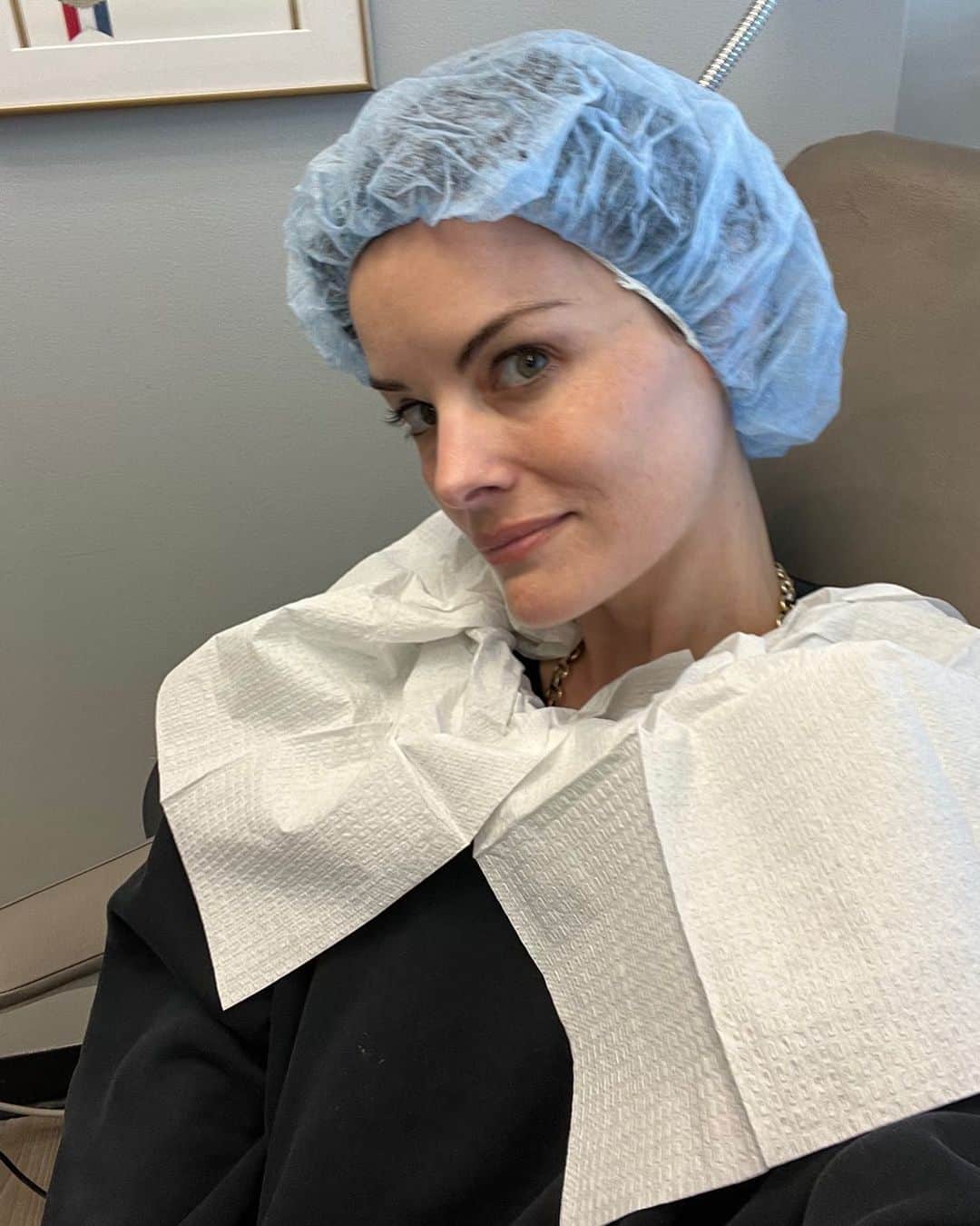 ジェイミー・アレクサンダーのインスタグラム：「Face peel time but make it fashion 🥴 #melasma #dermatology」