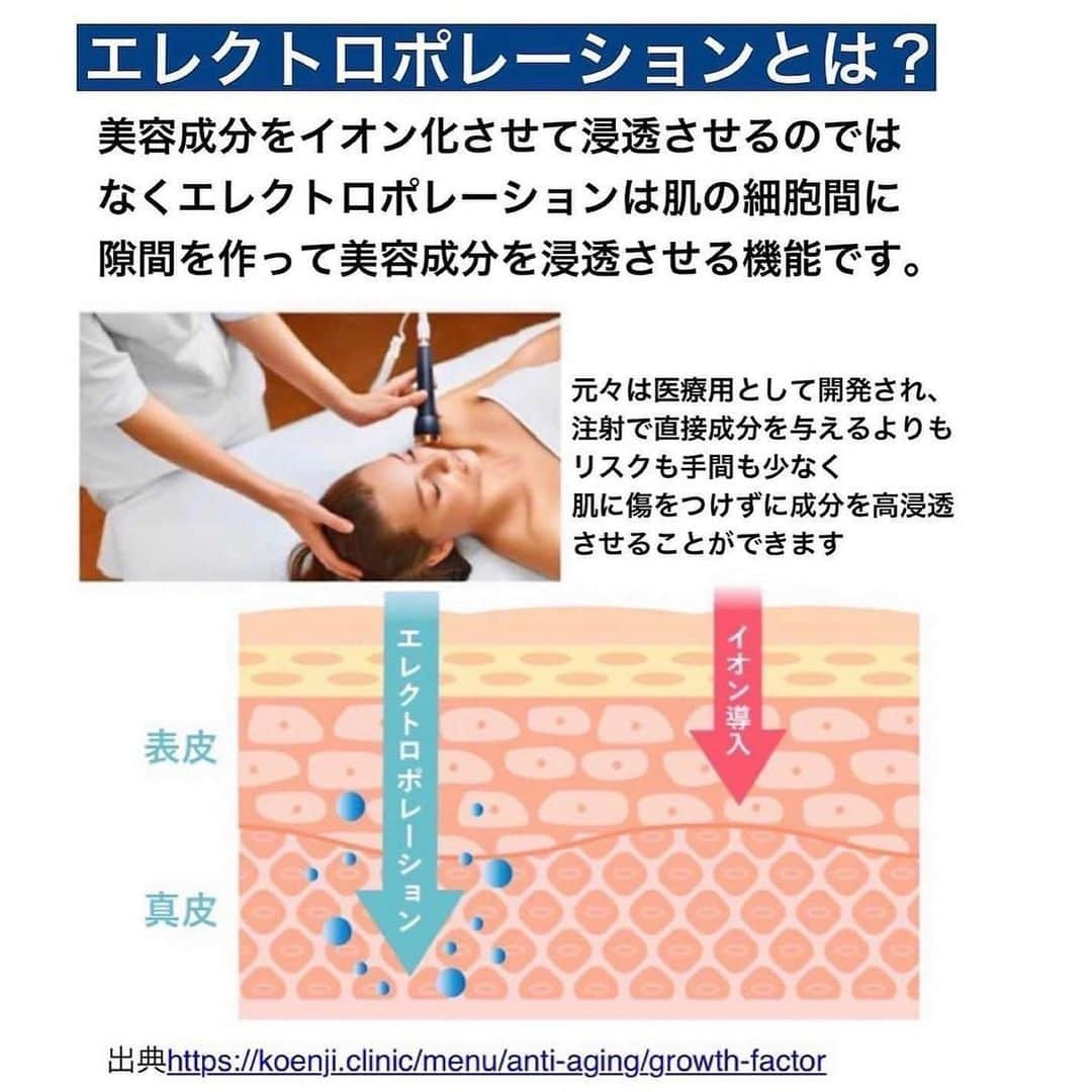 化粧品子さんのインスタグラム写真 - (化粧品子Instagram)「たるみは美顔器！マスク外してドヤ顔に。フェイスラインや目の下に。針を使わない水光注射ララルーチュRFの 秘密とは？ 4月9日日まで限定。 📍定期なし5千円オフ   クーポン出てました！ 今回は分割も5千円オフ！  くわしくはストーリーへ👇 @keshouhinko1225   おうちで美容施術級ケア。 10万円の価値の美顔器。 しかも出力が他の美顔器と比べて高いのにビリビリしない。  7つの機能の中のオススメに エレクトロポレーションがあります。 【エレクトロポレーションとは？】 イオン導入と同じように 電気の力で美容成分を高浸透が 出来ますが圧倒的な違いは美容成分を イオン化させて浸透させるのではなく、 エレクトロポレーションは肌の 細胞間に隙間を作って美容成分を 浸透させる機能です。  元々は、医療用として開発され、注射で直接成分を与えるよりもリスクも 手間も少なく、肌に傷をつけずに 成分を高浸透させることができます。  手やコットンで化粧水や美容液を 塗るよりも、美容有効成分の浸透率は 約130倍と言われています。  真っ赤にならない、ダウンタイム不要で当てるだけの水光注射といわれています。  エステや美容皮膚科で受ける エレクトロポレーション施術は、 1回5,000円〜1万円前後で、 効果を持続させるためには何度も受けなければいけません。  そう考えたら、美顔器購入後は化粧品を買えばいいだけ、スイッチを入れたらいいだけのララルーチュは時間のない女性に嬉しいし、美顔器としてかなりおトクです。首の側面の肩コリも解消されて、めちゃくちゃ気持ちいいです。  ララルーチュは エレクトロポレーションの他に  表情筋を鍛えるEMSや コラーゲン繊維に働きかけるラジオ波、 光の効果で肌を整えるLED、 エステと、5つの機能が同時に使える便利な美顔器です。 1回の使用がたったの5分と短時間なので、忙しい方にもうれしいし、続けやすい！  週に2、3回の使用で たるみやしわ、乾燥、くすみ、シミと 年齢トラブルを総合的にケアできます！ 美顔器本体は、卵1個分の重さなので、 片手でケアしても手が疲れません。   【ラジオ波とは？】 ラジオや無線と同じ周波数帯域のため、 ラジオ波と呼ばれます。 下記の効果が期待できます。  コラーゲンやエラスチンを増やす効果 たるんでしまった コラーゲン線維を引き締める効果  引き締まることによるリフトアップ 二重あごスッキリ 毛穴の引き締め効果 小顔効果  ラジオ波の熱で 体内でヒート・ショック・ プロテインという タンパク質の量が増えます。  真皮のコラーゲンやエラスチンを活性化させ、肌にハリとツヤを与えます。 また、余分な脂肪を燃焼する効果も 小じわの改善や たるんだフェイスラインを キュッとリフトアップ 頬の位置や、目の高さ、口角の位置が 上がる効果が期待できます！ ほうれい線の改善も期待できます。  #美顔器 #ララルーチュ #美顔器効果 #美顔器マニア #美顔器ランキング #ラジオ波フェイシャル #エレクトロポレーション #ems #表情筋 #ほうれい線改善 #目の下のたるみ」4月7日 17時44分 - keshouhinko1225