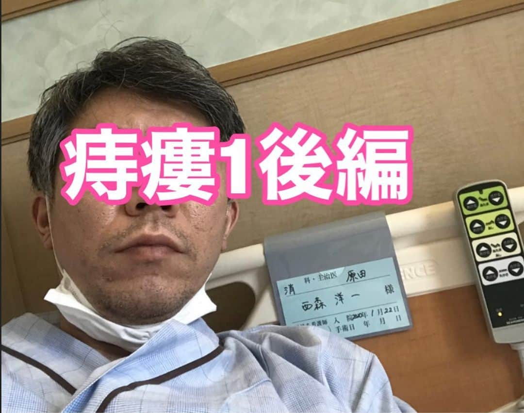 のインスタグラム：「2017.6.19「入院一日目」後半❗️  さっきから、入院しています。　 、 時はさかのぼる事、ちょっと前。 する事が無くなってから30分経った午前11時半……勝手に外へ出て、タバコ吸ったよ。 、 身体にGPSを埋め込まれて無いので、勝手に外へ出たよ。 、 「人に危害を加える訳では無いし！」……と、 このスローガンがあれば、オッサンは直ぐにルールを破る。 、 本当は外出も駄目で、院内は全面禁煙。 という事は、もう今日は吸えない筈だった。 、 でも、勝手に外に出て吸った。 、 駄目だと言われると、いつもより余計に、美味しく感じる。 毎喫煙で「駄目ですよ」と、言ってくれる人を雇いたい。 、 、 そして、、今日から4泊する。　 、 泊まり過ぎじゃない？　 、 痔で入院する日数じゃない事ない？ 、 で……今14時2分、ベッドの上、、、時間経つの遅い。 、 都会から離れ、大自然の中で、ゆっくりとした時間の流れの中、暮らしてみませんか？………… 、 「はぁ？  こっちの方がゆっくりやわ！ 」 、 14時あたりで、血圧を測ったりするらしく待っている、、その次のは、19時に測りに来る。 、 合間また勝手に外へ出て、吸おうと思っています。　　というか……もう決めています。 、 『もうラーメンの口になってる』みたいな感じで… 『もうタバコの肺になってる』 、 病院と地下で繋がっている.すぐ隣のビルに、オープンカフェがあった。 堂々と、そこでコーヒー飲んで、タバコ吸おうかなぁ…。 、 そこのカフェでタバコが吸える事も確認済みです。 私は、ヘビースモーカーの鏡です。 、 今、14時の血圧測定が終わった。 、 はい！今、吸うてます。  カフェはやめました。  外です。  、 続けて２本、吸うてます。 、 私は、ヘビースモーカーの鏡です。 、 病室戻って15時…… 今､、渡された書類に目を通してます。  「術後の過ごし方」などが書かれています。 、 「術後は大便を、1日2回までに､抑えてください」、とあった。　  いや、そんなうまいことコントロール出来るか！ 、 「多くても、3回以内にして下さい」 いや、そんなうまいことコントロール出来るか！ 、 「固くもなく、ゆるくもない、便にして下さい」 いや、そんなうまいことコントロール出来るか！ 、 「だいたい、練り歯磨き程度の硬さにして下さい」 いや、だから………… そんなうまいことコントロール出来るか！ 、 無理言うな！  そんなけコントロール出来たら、すでに資格として持ってるやろ！ 、 「排便スペシャリスト」とか、そんな感じの！ ｢排便シャルプランナー｣ とか。 、 、 17時頃、嫁と子供2人が見舞いに来るらしい。 まだ何もしていないプレーンな、いつも通りの西森を見に来るらしい。 、 何の意味があるのだろう……。 、 『病室行くからな！！』と嫁は何故か嬉しそうだった。 、 まだ後……二時間弱ある。　…………暇だ。 、 そして……今……家族来た。　 、 うるさ過ぎるので、直ぐに帰って貰った。 、 なんか起こるかも！と、 三人部屋にしたのが、間違いだった。 子供の声は通り過ぎる。　直ぐに帰って貰った。 、 その後、、夜ご飯食べ終わって、午後10時消灯。　 、 お坊さんちゃうから……こんな早い時間に寝られへん。 、 入院中は、病院食しか食べられ無いので、、 退院した時に「絶対.良えもん食うたろう」と、 この辺の美味しそうな店を、夜中1時ぐらい迄、約3時間程､探しまくった。 、 ほんで疲れて寝た。 、 おやすみなさい。 、 😀このような日記が本になっています amazon『西森洋一』で検索！ 、 日記朗読ライブもあるよ！」