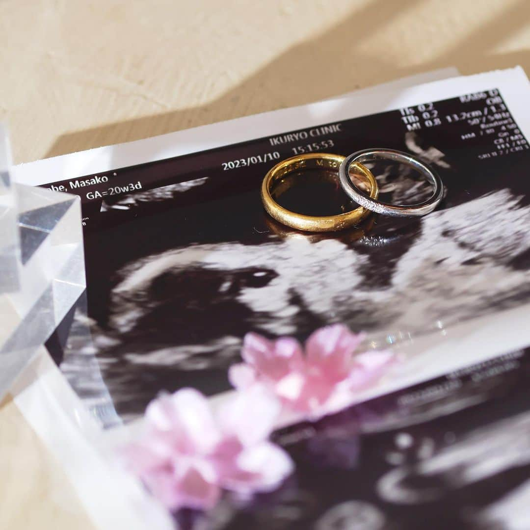 マコ・プリンシパルさんのインスタグラム写真 - (マコ・プリンシパルInstagram)「Echo pics of my baby👶💍💍  前撮りの時に、いっしょに撮影頂いた お腹の中の赤ちゃんの横顔  ちょうど指輪にキスしてるような構図！ 宇宙人みたいでお気に入り👽  毎検診みているから慣れてしまっているけれど、エコー写真て見方が難しいよね😳  🌸🌸🌸🌸🌸  気づけば臨月。 長いようで早いようで… 緊張と不安と幸福感が入り混じる心境の中、 いよいよ来る新しい仲間との対面に心躍る毎日です。  10月に悪阻が始まってから今に至るまで、絶えず続く体調不良（つわり、私の場合酷すぎて脱水になり点滴していた）から、後少しで解放されるのが本当嬉しい〜🥲♡  #havingababy #echopictures」5月4日 19時06分 - makopuri