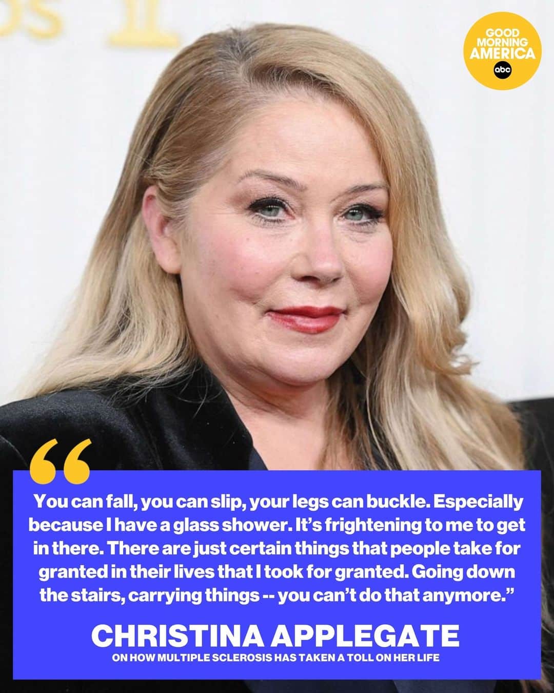Good Morning Americaさんのインスタグラム写真 - (Good Morning AmericaInstagram)「Christina Applegate is opening up about how multiple sclerosis has taken a toll on her life. The actress, who is known for her roles in “Dead To Me,” “The Sweetest Thing” and “Anchorman,” said having MS “f---ing sucks.”  “With the disease of MS, it’s never a good day,” she said in an interview with Vanity Fair . “You just have little s----- days.”  MORE on what she said at the link in bio.  #ChristinaApplegate #MultipleSclerosis #Health」5月6日 5時00分 - goodmorningamerica