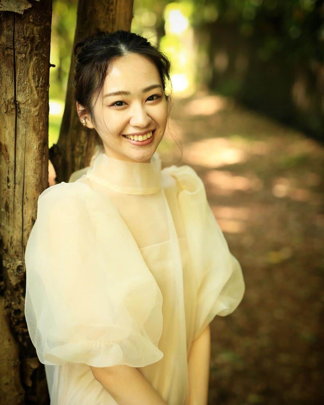 光永百花のインスタグラム：「・  おでこ火傷しました。」