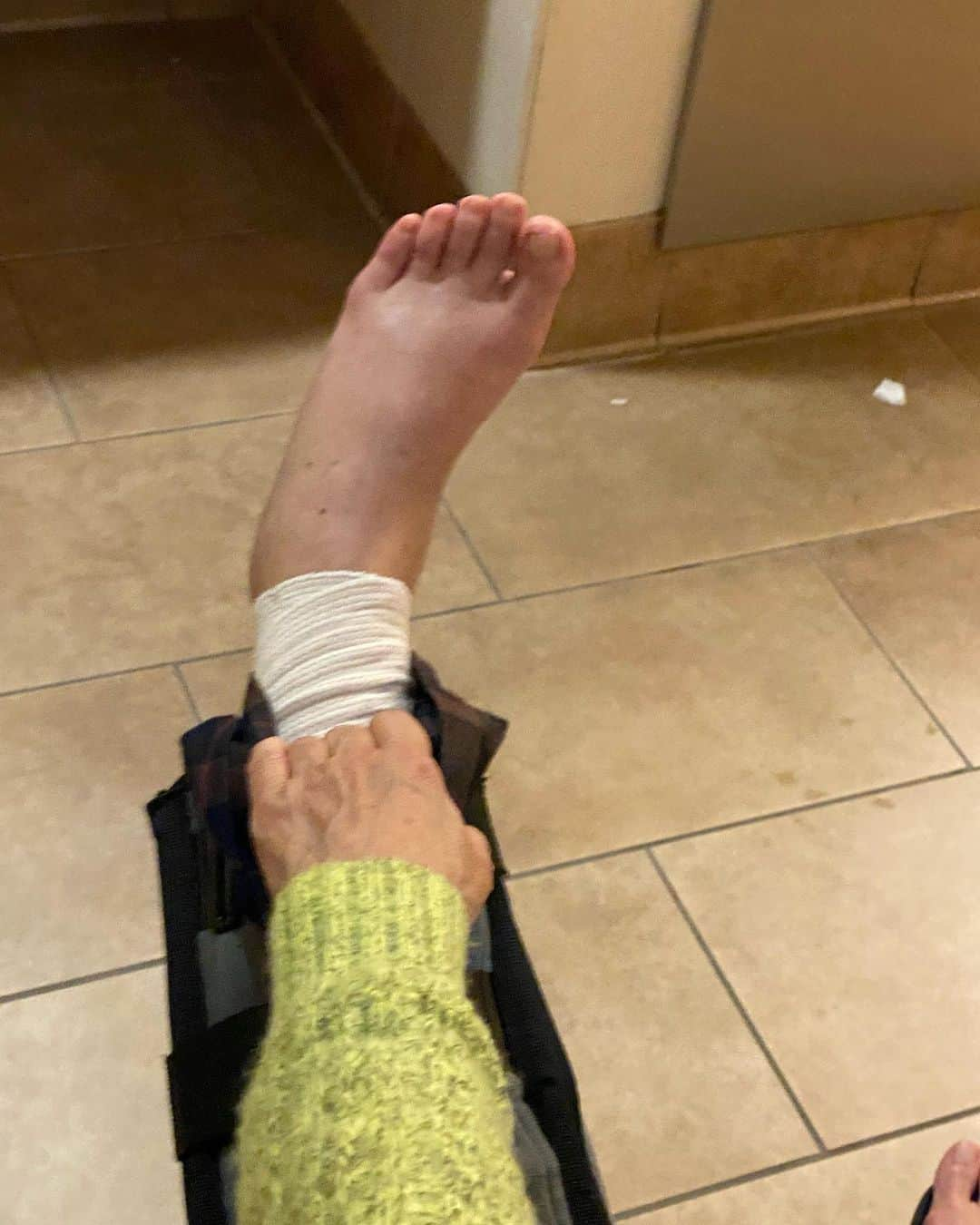 エビアン・クーさんのインスタグラム写真 - (エビアン・クーInstagram)「Mama fell at the store when her shoes got caught on a plastic bag - and landed on her knee cap. We got X-ray done, it showed her knee cap was fractured. Got surgery a week ago. What’s amazing about my mom is, she is strong that she didn’t want to cancel my trip; Fukuoka & Taiwan. She didn’t want to be a burden, so she wanted me to go on the trip. Mama you’re truly the best, you work the hardest, funniest and always teaches me to enjoy life. I know you’re sad about not joining us, but once you’re well, we will all go on a vacation but meanwhile you deserve all the rest you need. I need you to recover!! Thanks for those who’s been reaching out to us!  **She looks happy but she’s in pain…   P.S ILA loves strawberries 🍓   ママは店で靴がビニール袋に引っかかって転んで、 足のひざお皿をわっちゃったの。 X線を撮ったところ、 膝蓋骨が骨折していることがわかって😅 本当にママはいつもせっかちで。  1週間前に手術をしたんだよね。 私の母の素晴らしいところは、 私の旅行をキャンセルしたくなかったみたいで福岡と台湾のプランを変えないでって。本当にいつも自分を2番目にする。  足は今こんな状態だけどいっぱい休んで欲しい。 ママは一番一生懸命働いて、一番面白くて、 人生を楽しむことをいつも教えてくれる。  気遣ってママにメール送ってくれてありがとう 本当にいっぱいの人が愛情を❤️‍🔥ママにありがとう 幸せものです。」5月7日 2時11分 - avian_official