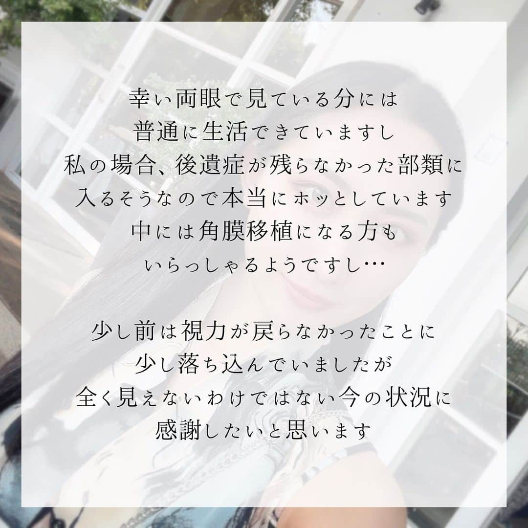 aya onoさんのインスタグラム写真 - (aya onoInstagram)「この前K-pop好きの友達から、『aespaのニンニンちゃんもあやてんと同じ病気で右目ほとんど見えてないらしいよ』と教えてもらいました。 「ほとんど見えない」と言うことなので、私よりももっと大変な状況の中、歌って踊って活躍している彼女。それを知って、できないことなんてないと改めて感じました。  右目視力は回復することはもうないみたいなので、今の視力でどう仕事をしていくかを考えている段階です。  先日、ちょうど私と同じくらいの時期に息子さんがアカントアメーバに罹患されたと言う方からDMをいただきました。 今どんな状態なのか、視力はどのくらい回復したかなど共有させていただきました。  私も他の方がどこまで視力が回復したのか、混濁は改善するのかなど色々気になり調べていたので、不安な気持ちものすごくわかります。 このアカントアメーバ角膜炎、カラコン着用や不正なコンタクトレンズの使用で年々増えているみたいなので、今の状況を書かせていただこうと思います。  現在は点眼治療中で、3月半ばから2種類の目薬を1日6回、4月半ばからは1日4回に回数を減らして点眼中。 充血や痛みといった症状は何もなく、ぱっと見は左目と変わりません。  混濁が残っているので、少し白くモヤがかかったように見えます。そのせいか、右目は少し眩しさが感じやすい気がします。  視力はものすごく悪いわけではありませんが高校生からコンタクト生活。罹患した右目は、-2.00のメガネ・コンタクトをしていました。(左目の方が視力悪い) 罹患後も裸眼視力は多分変わらず0.3。 矯正視力も0.3。 つまりメガネしてもしなくても同じです😭  元々視力はどこまで回復するかわからないと言われていましたが、視力戻らなければ度数あげればいいと思っていた私 そうゆう問題ではありませんでした  何度も角膜を削ることで(掻爬)、角膜の表面がボコボコになり不正乱視になる可能性が高いんです。 普通の乱視のようにメガネやソフトコンタクトでの矯正は不可能で軽度の不正乱視ならハードコンタクトで矯正できるようです。  実際混濁のせいなのか、不正乱視のせいなのかわかりませんが、先生は混濁の影響が大きいと仰っていました。 なのでハードにしても変わらないんじゃないかという見解。  毎日メガネして左目は1.0、右目は0.3で生活していて、最初は距離感が掴めなかったり気持ち悪くなってたけど、人間って不思議なもので慣れるんですよね〜  それで昨日左目だけコンタクトしたら、違和感しかなく… やっぱりメガネとコンタクトって見え方違うのね  仕事上ずっとメガネというわけにはいかないので、完治したら一応ハードコンタクトも試してみようかなと思っています。  幸い両眼で見ている分には普通に生活できていますし、私の場合、後遺症が残らなかった部類に入るそうなので本当にホッとしています。 中には角膜移植になる方もいらっしゃるようですし…  少し前は視力が戻らなかったことに少し落ち込んでいましたが、全く見えないわけではない今の状況に感謝したいと思います。  そして声を大にして言いたい。 なってからでは遅い！2weekを何ヶ月もつけてるって子や1dayを一度も外さず数日着用しっぱなしって子もいたり…なってからでは遅いので、コンタクトは正しく着けましょう  確かに世界大会の時はコンタクト着用時間が18時間くらいの時もあったけど、ワンデーのクリアレンズで過ごしてた私がなったんだから 洗うタイプの使ってる人は特にお気をつけください  そしてもう一つお願い🙇🏻‍♀️ アカントアメーバ角膜炎を経験されたことのある方がいらっしゃったらコメントでもDMでも、視力がどこまで回復したか、その後の生活がどうなったか教えていただけると、とっても助かります もしいらっしゃったらお願いします🥺  #アカントアメーバ角膜炎 #角膜炎 #ブドウ膜炎 #コンタクトレンズ障害 #眼科 #目の充血 #目痛い #目の病気 #目の不調 #aespa #ニンニン #カラコン #カラーコンタクト #闘病中モデル」5月7日 17時10分 - onoaya_official