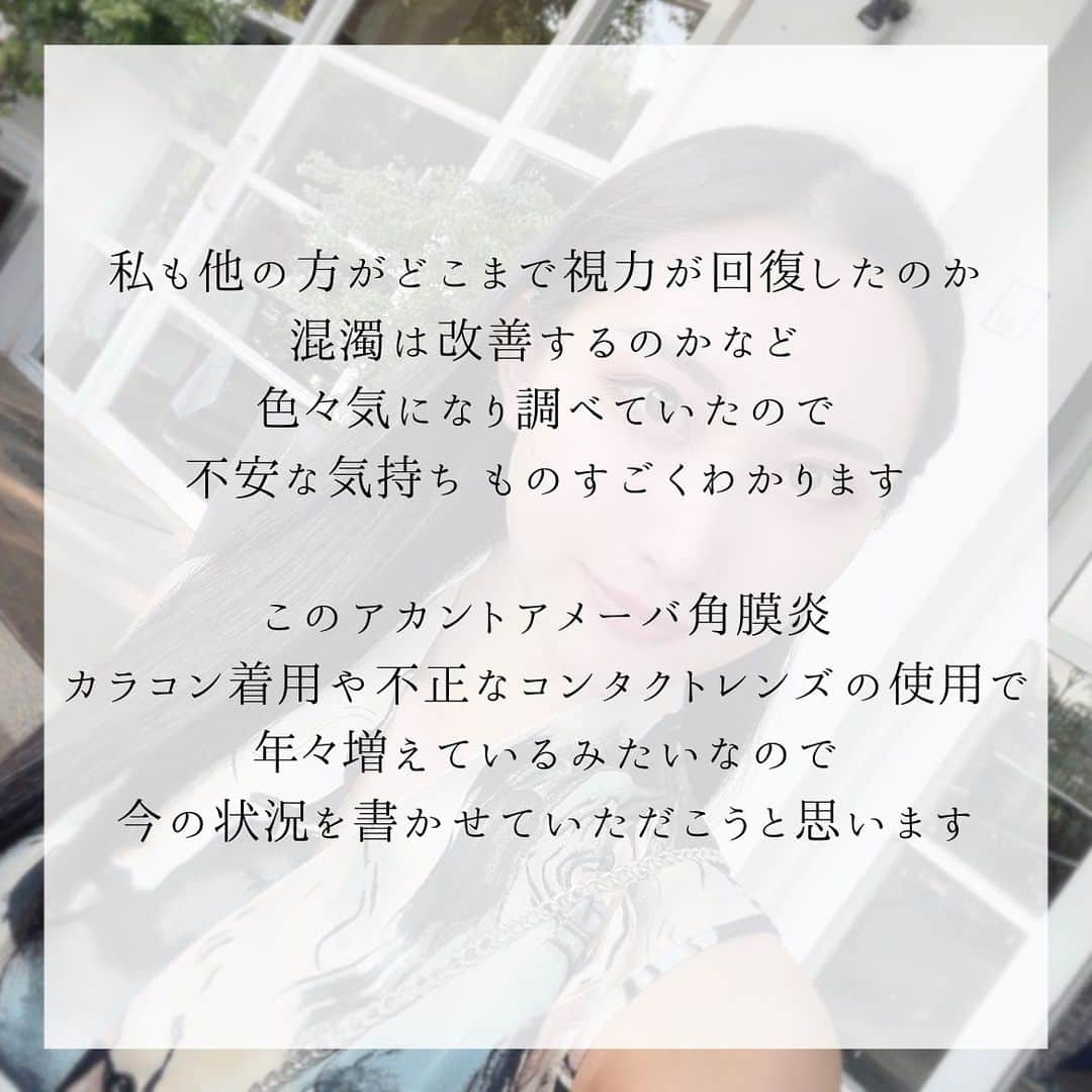 aya onoさんのインスタグラム写真 - (aya onoInstagram)「この前K-pop好きの友達から、『aespaのニンニンちゃんもあやてんと同じ病気で右目ほとんど見えてないらしいよ』と教えてもらいました。 「ほとんど見えない」と言うことなので、私よりももっと大変な状況の中、歌って踊って活躍している彼女。それを知って、できないことなんてないと改めて感じました。  右目視力は回復することはもうないみたいなので、今の視力でどう仕事をしていくかを考えている段階です。  先日、ちょうど私と同じくらいの時期に息子さんがアカントアメーバに罹患されたと言う方からDMをいただきました。 今どんな状態なのか、視力はどのくらい回復したかなど共有させていただきました。  私も他の方がどこまで視力が回復したのか、混濁は改善するのかなど色々気になり調べていたので、不安な気持ちものすごくわかります。 このアカントアメーバ角膜炎、カラコン着用や不正なコンタクトレンズの使用で年々増えているみたいなので、今の状況を書かせていただこうと思います。  現在は点眼治療中で、3月半ばから2種類の目薬を1日6回、4月半ばからは1日4回に回数を減らして点眼中。 充血や痛みといった症状は何もなく、ぱっと見は左目と変わりません。  混濁が残っているので、少し白くモヤがかかったように見えます。そのせいか、右目は少し眩しさが感じやすい気がします。  視力はものすごく悪いわけではありませんが高校生からコンタクト生活。罹患した右目は、-2.00のメガネ・コンタクトをしていました。(左目の方が視力悪い) 罹患後も裸眼視力は多分変わらず0.3。 矯正視力も0.3。 つまりメガネしてもしなくても同じです😭  元々視力はどこまで回復するかわからないと言われていましたが、視力戻らなければ度数あげればいいと思っていた私 そうゆう問題ではありませんでした  何度も角膜を削ることで(掻爬)、角膜の表面がボコボコになり不正乱視になる可能性が高いんです。 普通の乱視のようにメガネやソフトコンタクトでの矯正は不可能で軽度の不正乱視ならハードコンタクトで矯正できるようです。  実際混濁のせいなのか、不正乱視のせいなのかわかりませんが、先生は混濁の影響が大きいと仰っていました。 なのでハードにしても変わらないんじゃないかという見解。  毎日メガネして左目は1.0、右目は0.3で生活していて、最初は距離感が掴めなかったり気持ち悪くなってたけど、人間って不思議なもので慣れるんですよね〜  それで昨日左目だけコンタクトしたら、違和感しかなく… やっぱりメガネとコンタクトって見え方違うのね  仕事上ずっとメガネというわけにはいかないので、完治したら一応ハードコンタクトも試してみようかなと思っています。  幸い両眼で見ている分には普通に生活できていますし、私の場合、後遺症が残らなかった部類に入るそうなので本当にホッとしています。 中には角膜移植になる方もいらっしゃるようですし…  少し前は視力が戻らなかったことに少し落ち込んでいましたが、全く見えないわけではない今の状況に感謝したいと思います。  そして声を大にして言いたい。 なってからでは遅い！2weekを何ヶ月もつけてるって子や1dayを一度も外さず数日着用しっぱなしって子もいたり…なってからでは遅いので、コンタクトは正しく着けましょう  確かに世界大会の時はコンタクト着用時間が18時間くらいの時もあったけど、ワンデーのクリアレンズで過ごしてた私がなったんだから 洗うタイプの使ってる人は特にお気をつけください  そしてもう一つお願い🙇🏻‍♀️ アカントアメーバ角膜炎を経験されたことのある方がいらっしゃったらコメントでもDMでも、視力がどこまで回復したか、その後の生活がどうなったか教えていただけると、とっても助かります もしいらっしゃったらお願いします🥺  #アカントアメーバ角膜炎 #角膜炎 #ブドウ膜炎 #コンタクトレンズ障害 #眼科 #目の充血 #目痛い #目の病気 #目の不調 #aespa #ニンニン #カラコン #カラーコンタクト #闘病中モデル」5月7日 17時10分 - onoaya_official