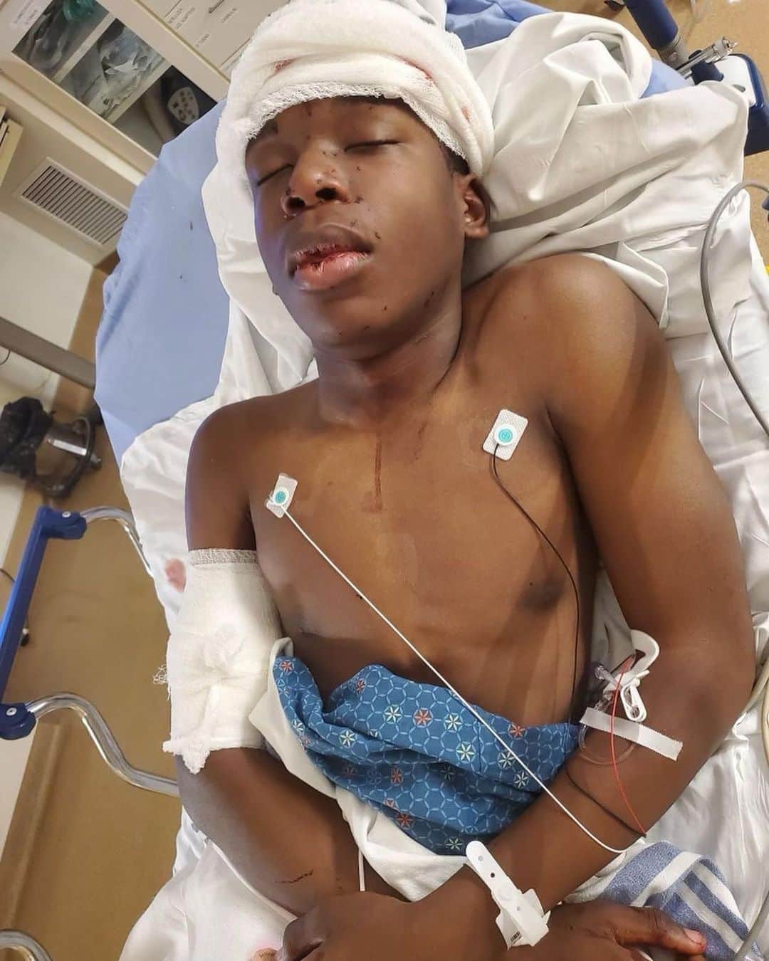 ジェニファー・ハドソンさんのインスタグラム写真 - (ジェニファー・ハドソンInstagram)「My God !!! Heartbroken for this young man and his family. Praying for his complete recovery ! #RalphYarl」4月17日 10時32分 - iamjhud